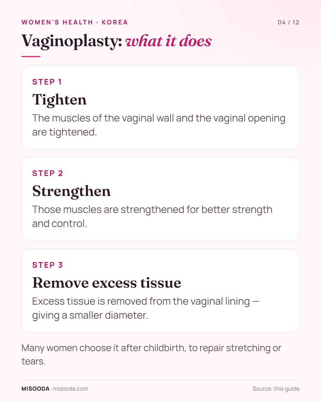 Vaginoplasty (vaginal rejuvenation) in Korea explained: tightening and strengthening the vaginal wall muscles and opening and removing excess lining tissue