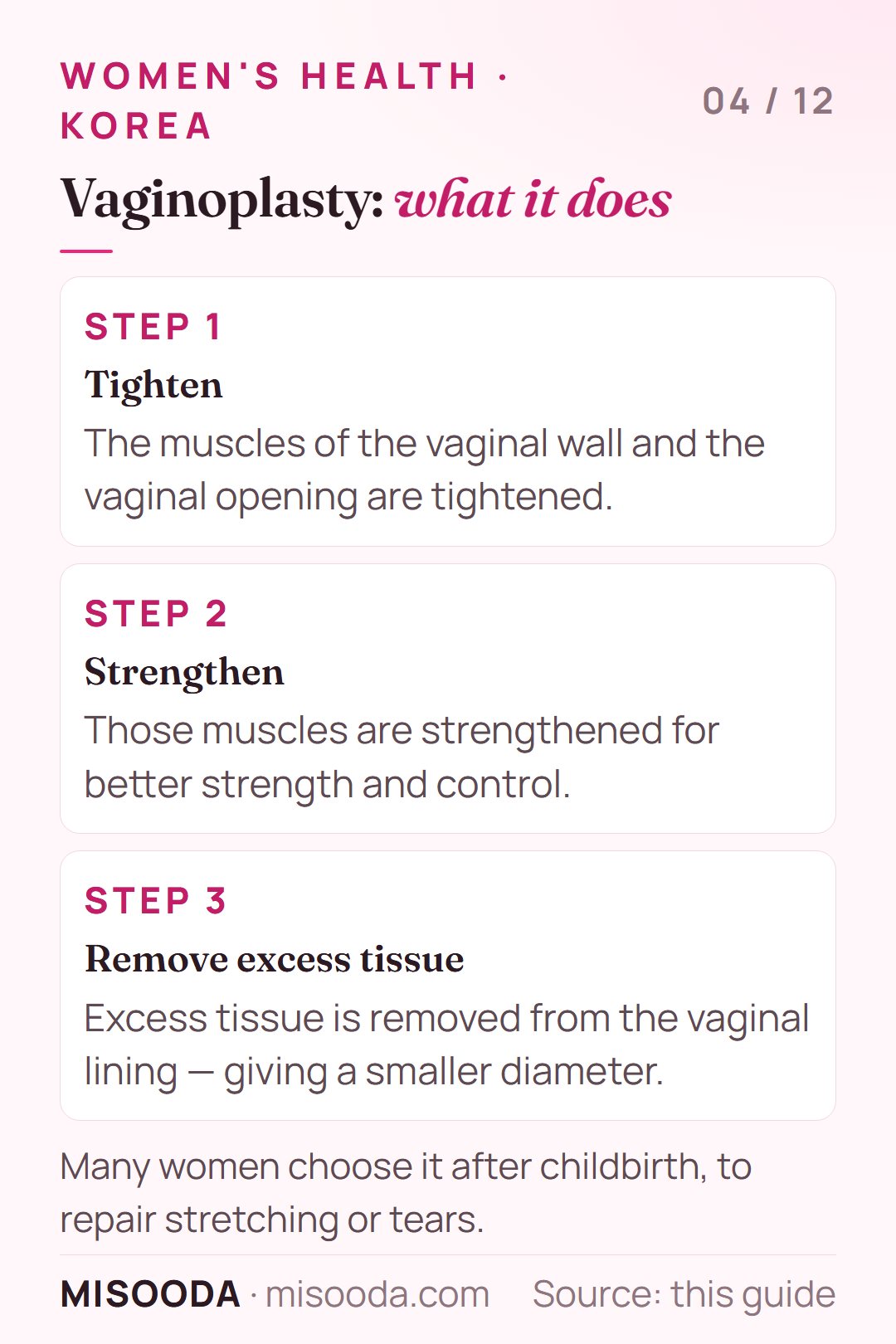 Vaginoplasty (vaginal rejuvenation) in Korea explained: tightening and strengthening the vaginal wall muscles and opening and removing excess lining tissue