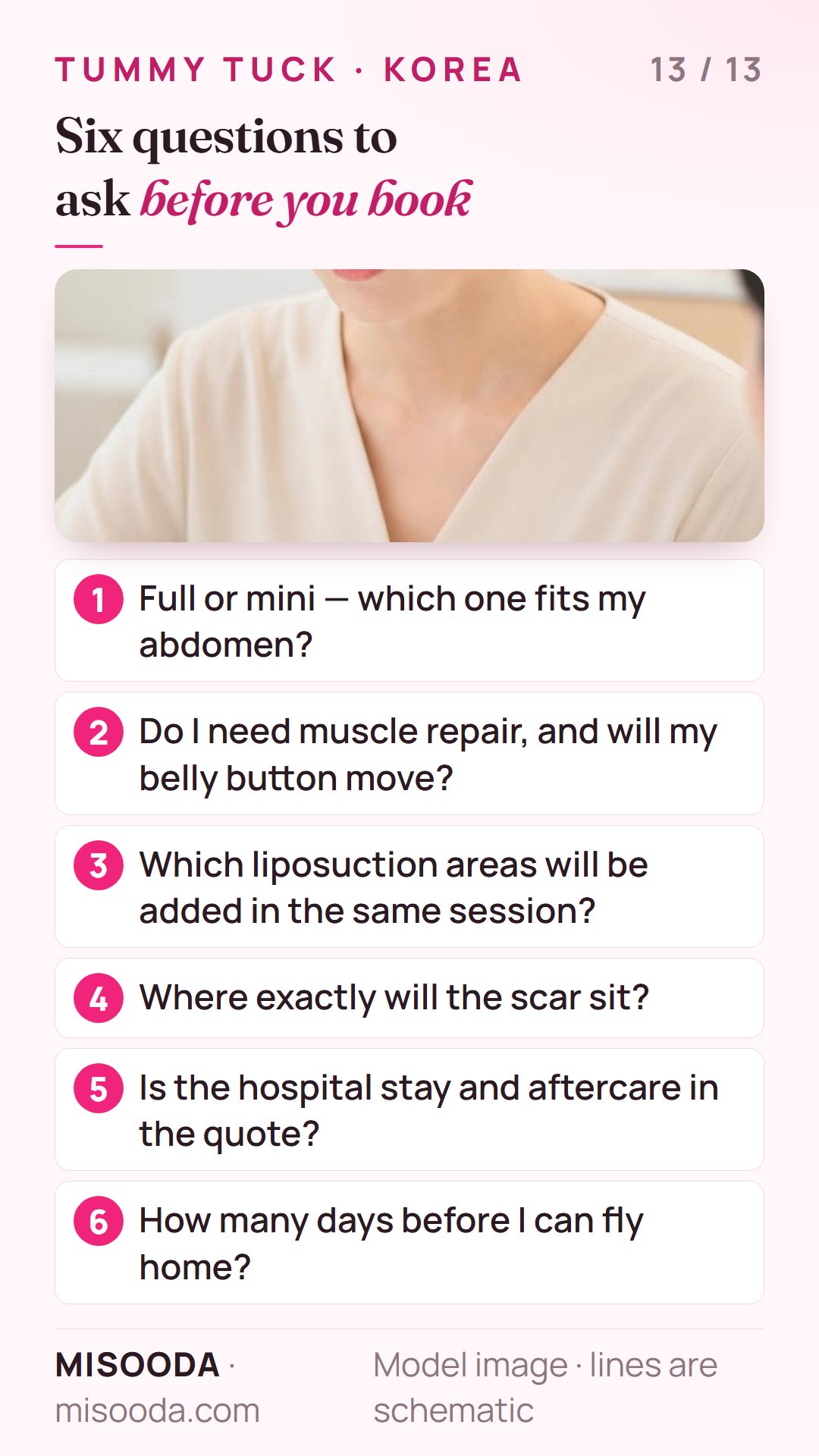 Six questions before booking a tummy tuck in Korea: full or mini, muscle repair and belly button, added liposuction, scar position, quote, stay length