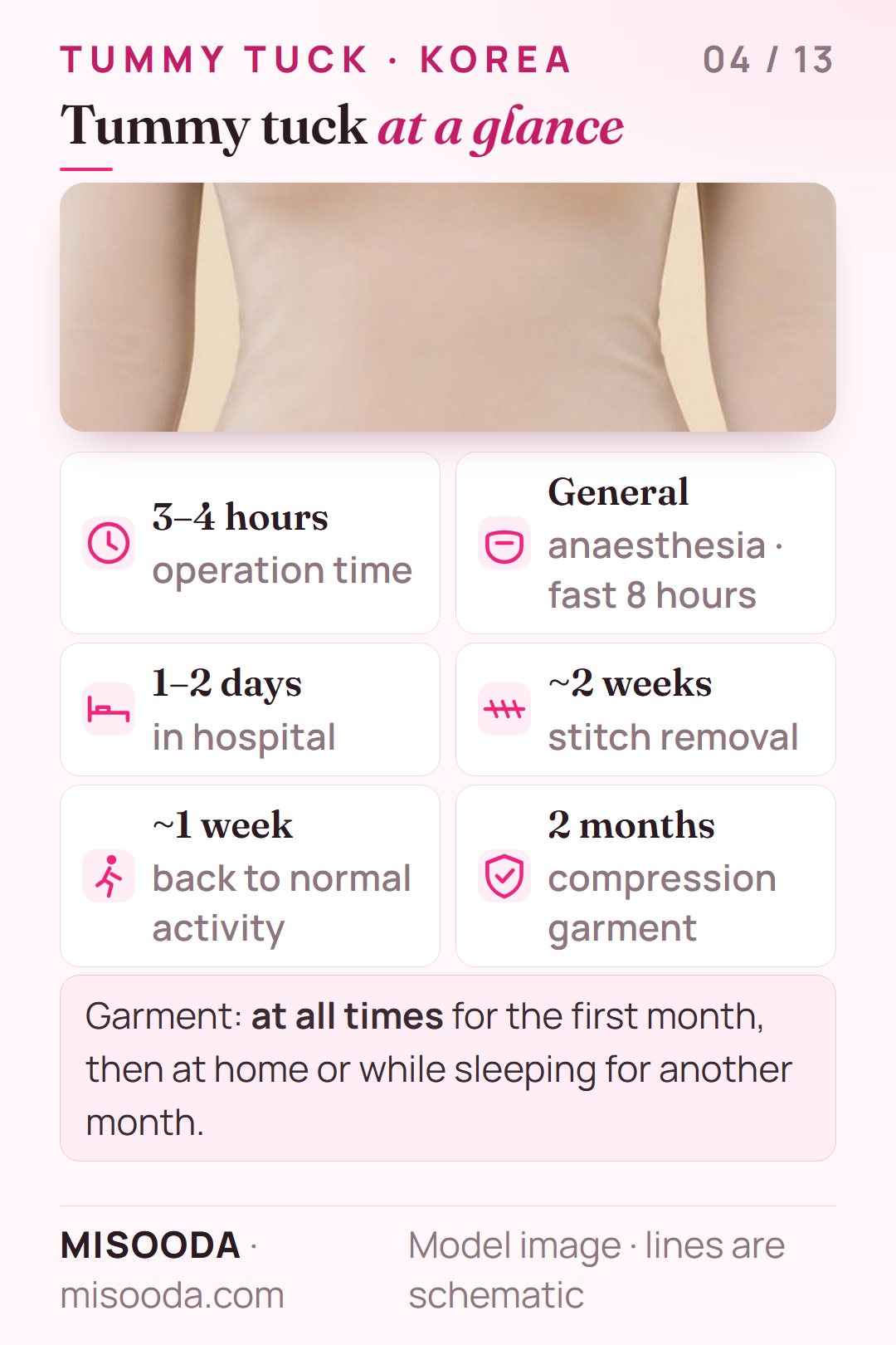 Tummy tuck quick facts: 3–4 hours under general anaesthesia, 1–2 days in hospital, stitches out about 2 weeks, normal activity after about 1 week