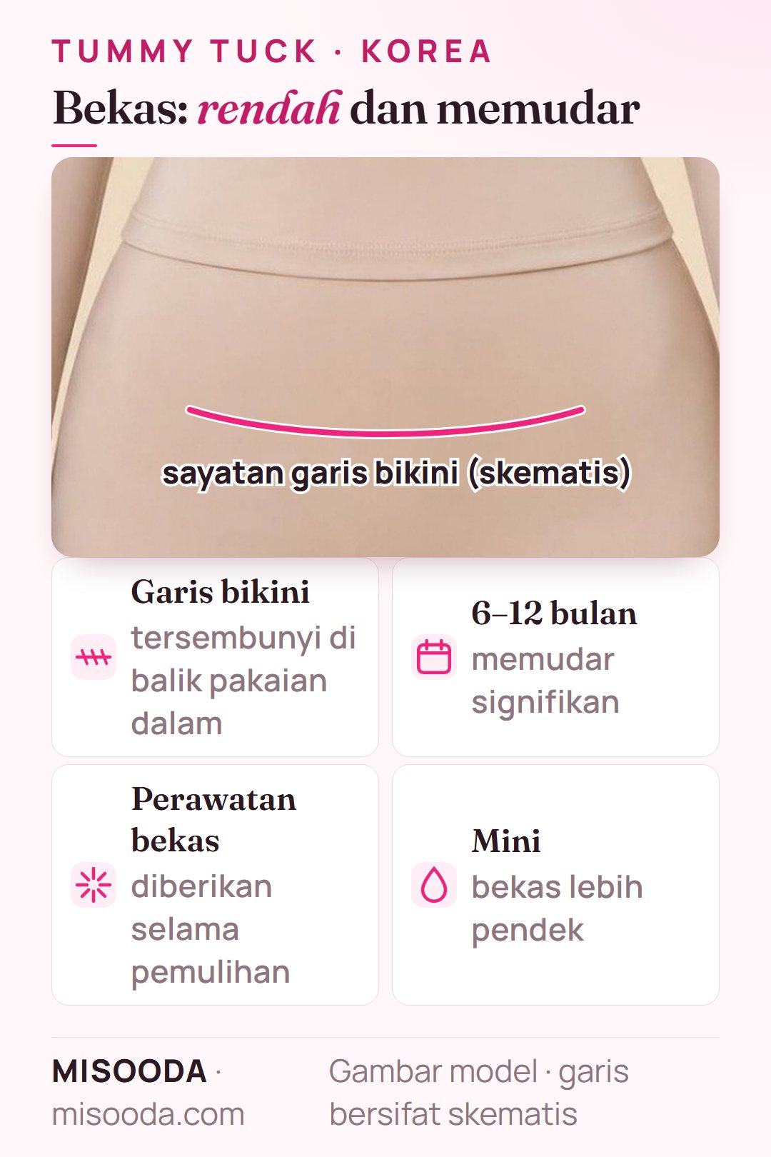 Bekas tummy tuck di sepanjang garis bikini, tersembunyi di balik pakaian dalam atau baju renang, memudar signifikan dalam 6–12 bulan dengan perawatan bekas