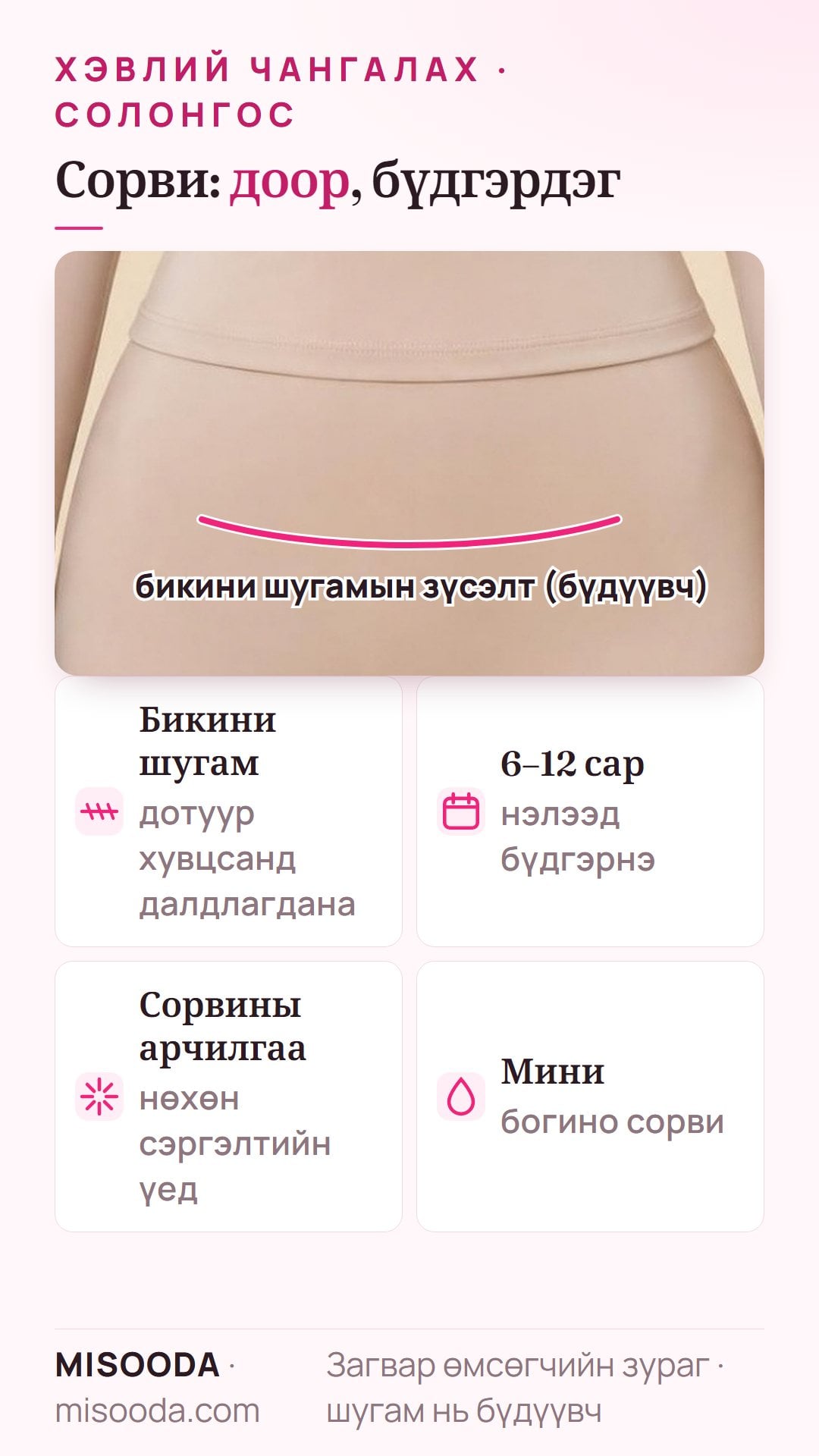 Хэвлий чангалах мэс заслын сорви бикини шугамаар, дотуур хувцас эсвэл усны хувцсанд далдлагдаж, сорвины арчилгаагаар 6–12 сард нэлээд бүдгэрнэ