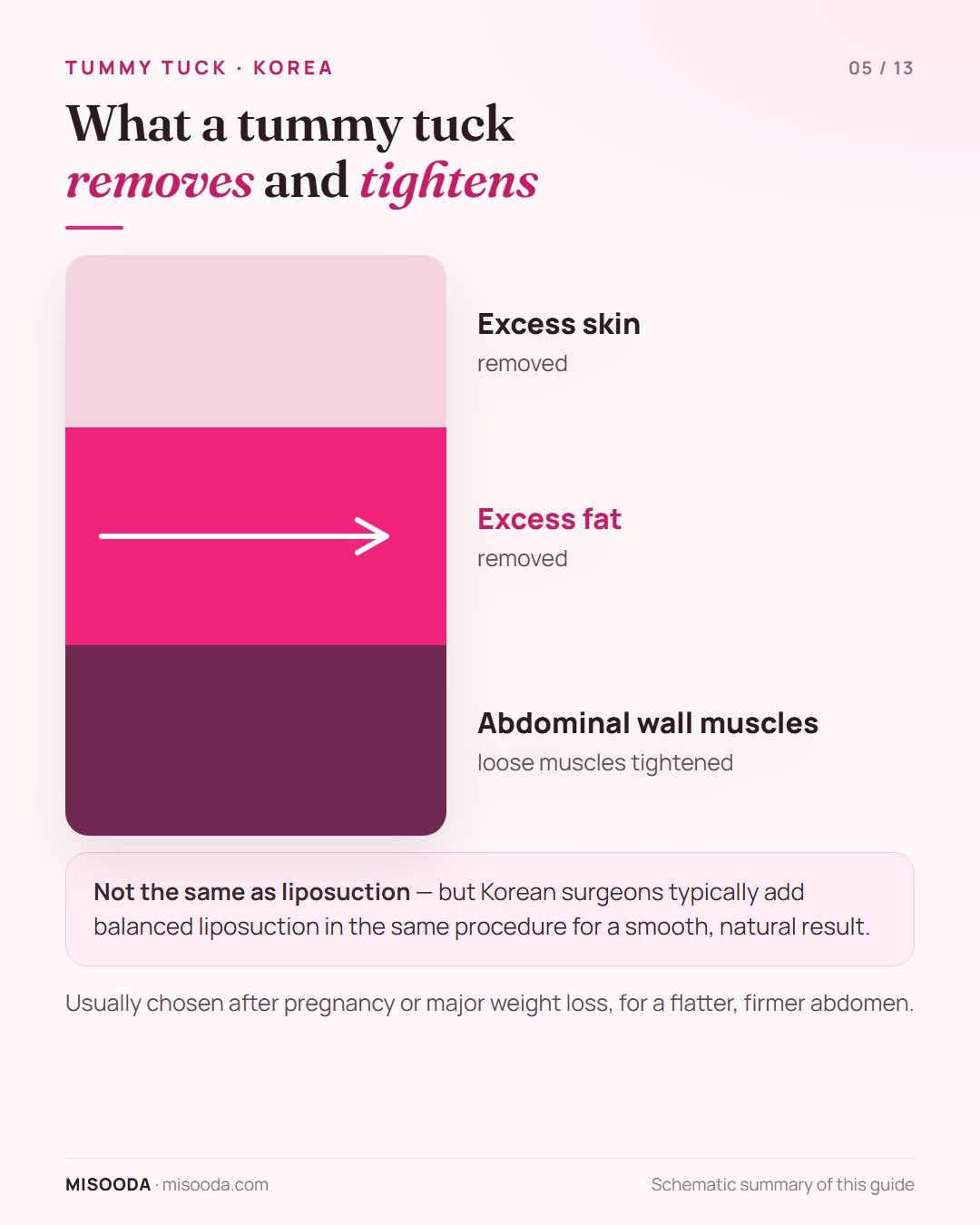 What a tummy tuck does: removes excess abdominal skin and fat and tightens loose abdominal wall muscles for a flatter, firmer abdomen