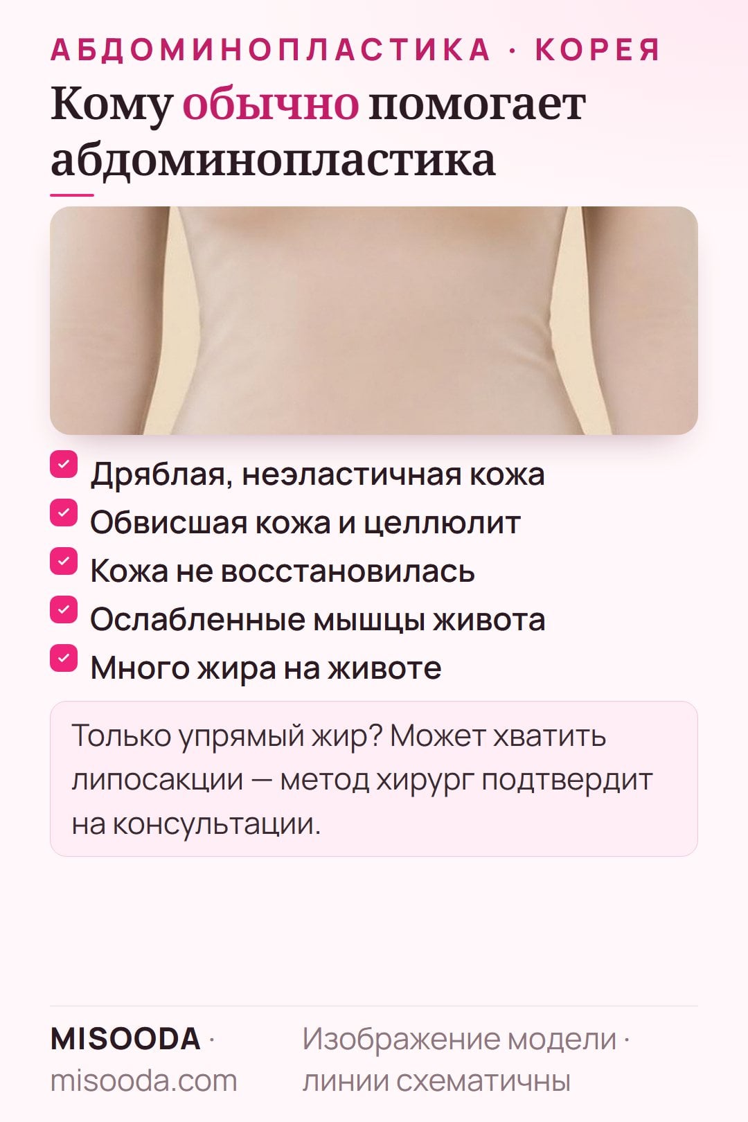 Кому подходит абдоминопластика: дряблая неэластичная кожа, обвисание после беременности, кожа не восстановилась после похудения, слабые мышцы живота