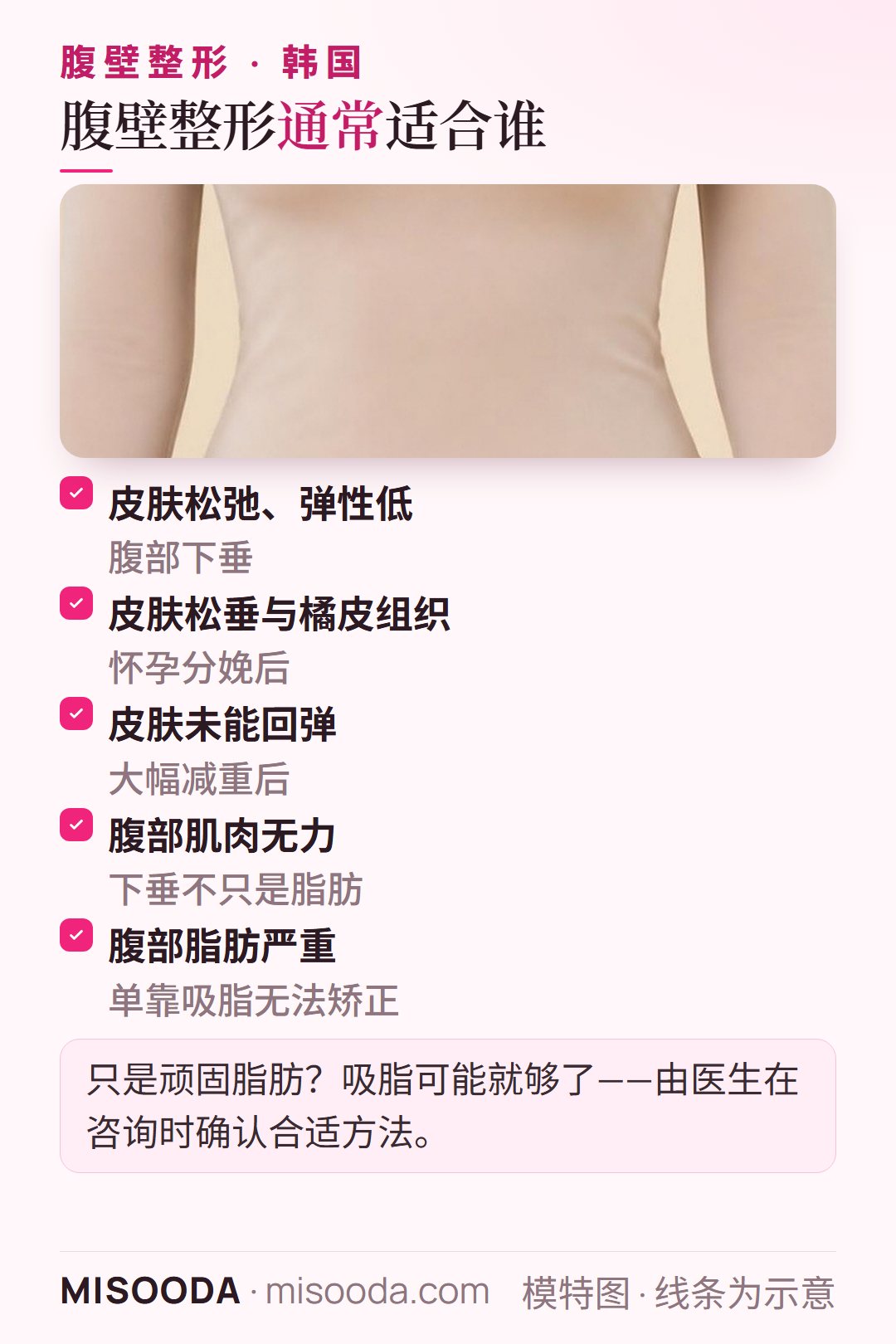 韩国 腹壁整形适合人群:皮肤松弛弹性低、怀孕后松垂、减重后皮肤未回弹、腹部肌肉无力