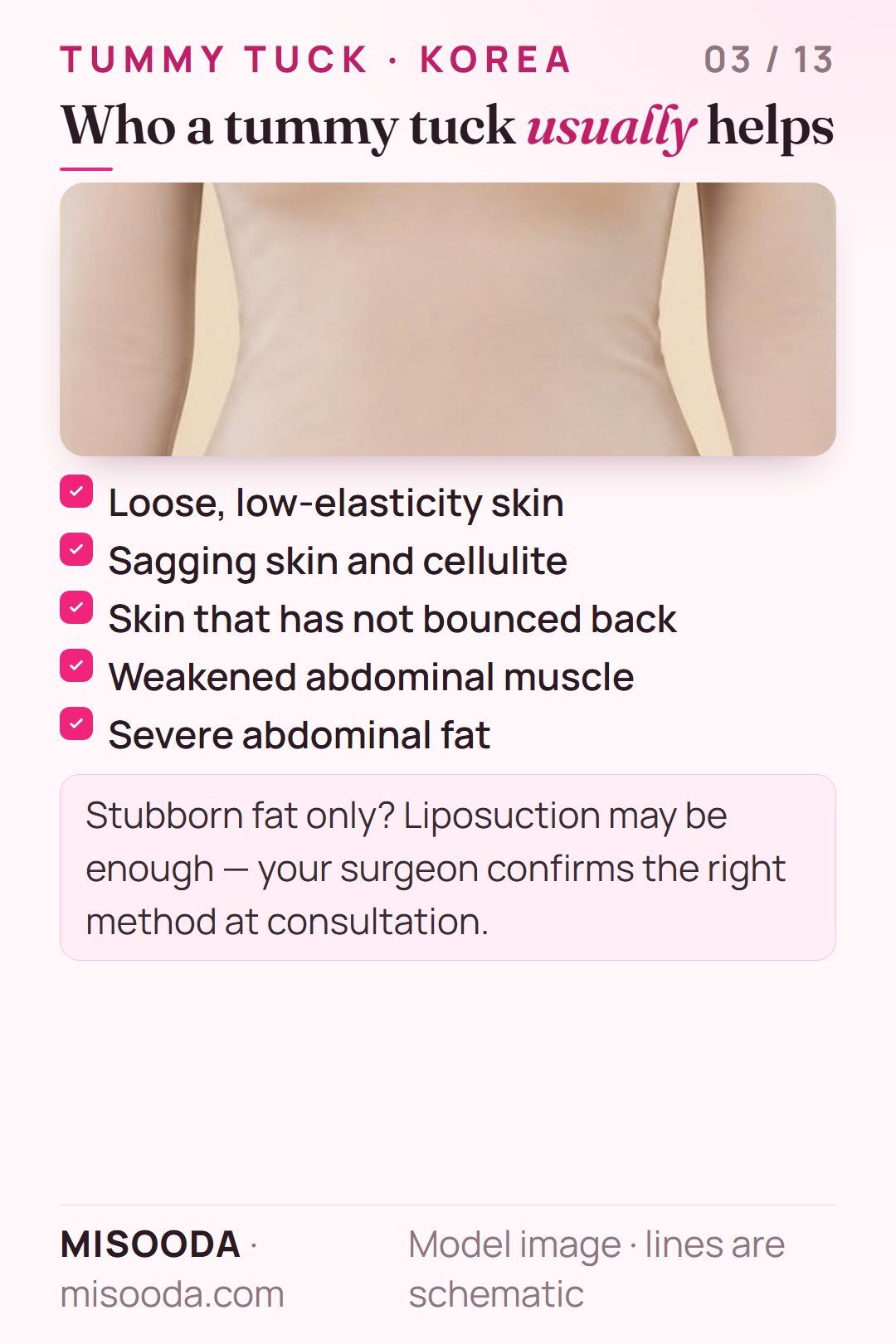 Tummy tuck candidates: loose low-elasticity skin, sagging after pregnancy, skin that did not bounce back after weight loss, weakened abdominal muscle