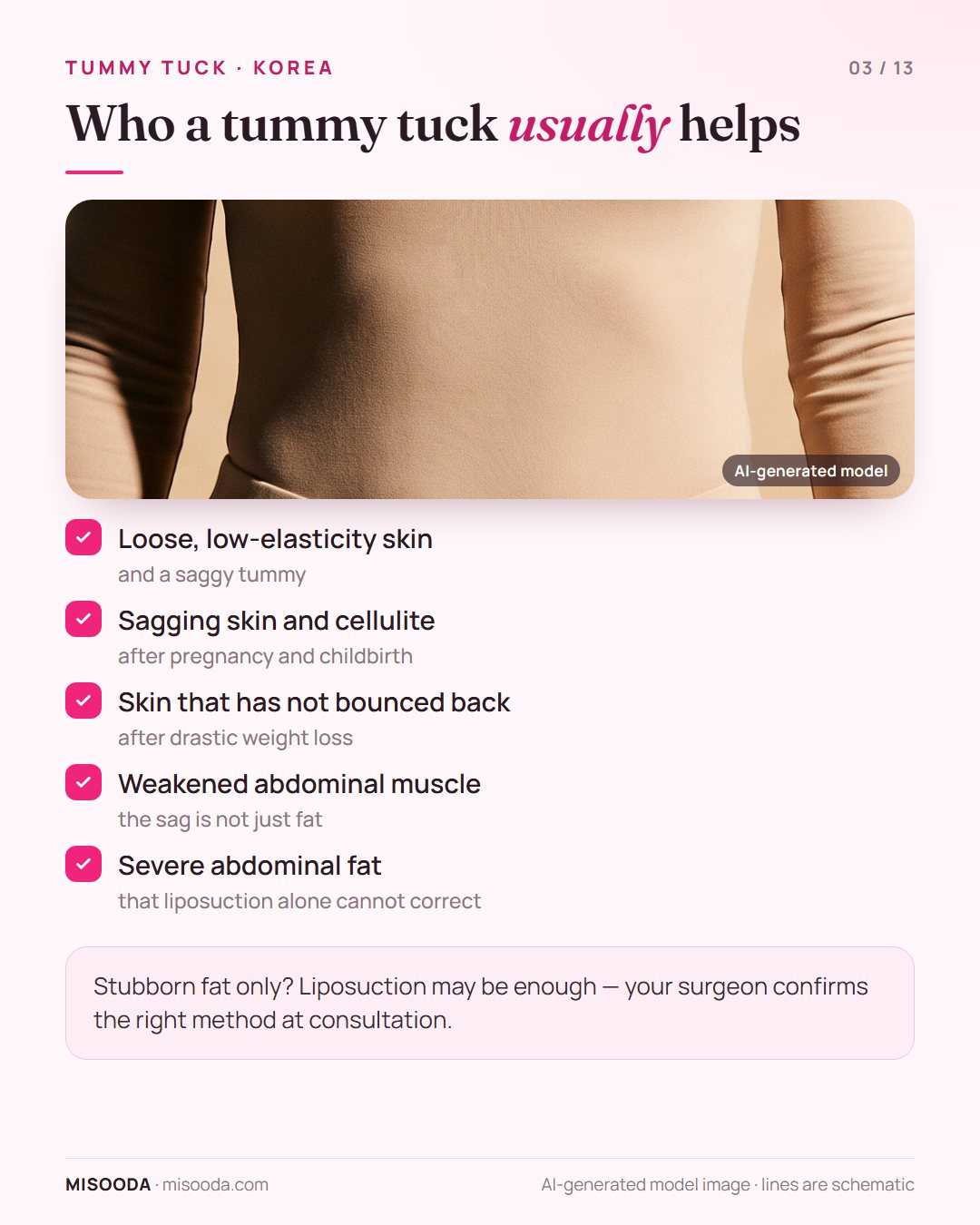Tummy tuck candidates: loose low-elasticity skin, sagging after pregnancy, skin that did not bounce back after weight loss, weakened abdominal muscle
