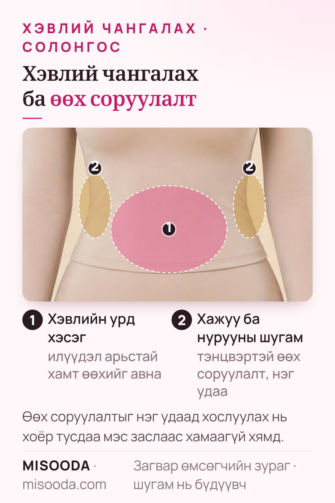 Солонгост хэвлий чангалахыг өөх соруулалттай хослуулах: хэвлийн урд, хажуу, нурууны шугамын тэнцвэртэй өөх соруулалтыг нэг удаад хийнэ