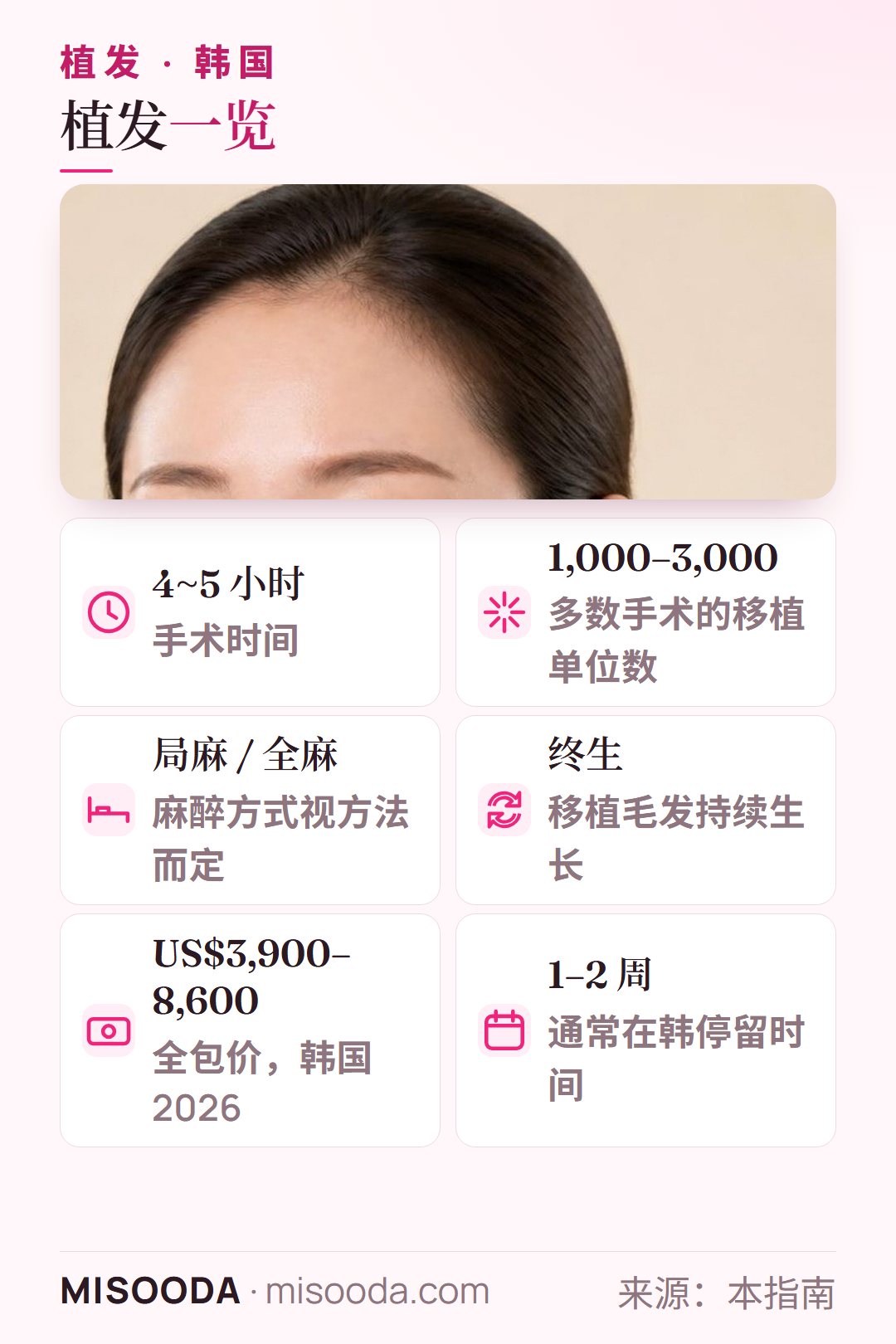 韩国 植发要点:手术 4~5 小时,移植 1,000–3,000 单位,局部或全身麻醉,毛发终生生长,韩国费用 US$3,900–8,600