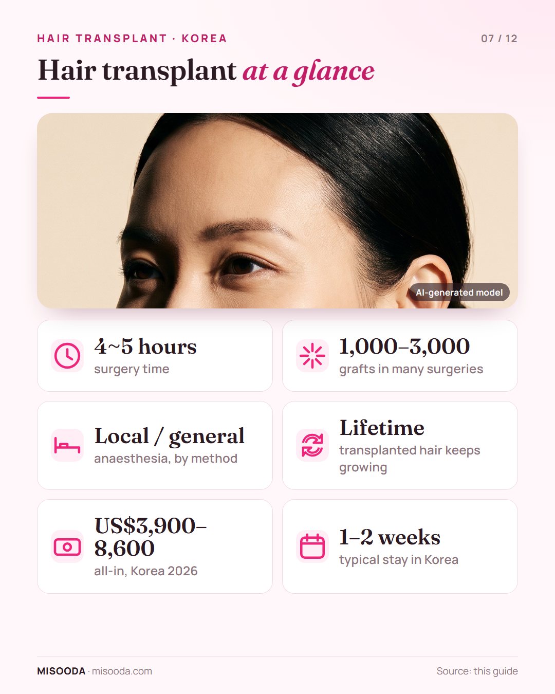 Hair transplant key facts: 4~5 hours of surgery, 1,000–3,000 grafts, local or general anaesthesia, lifelong growth, US$3,900–8,600 in Korea