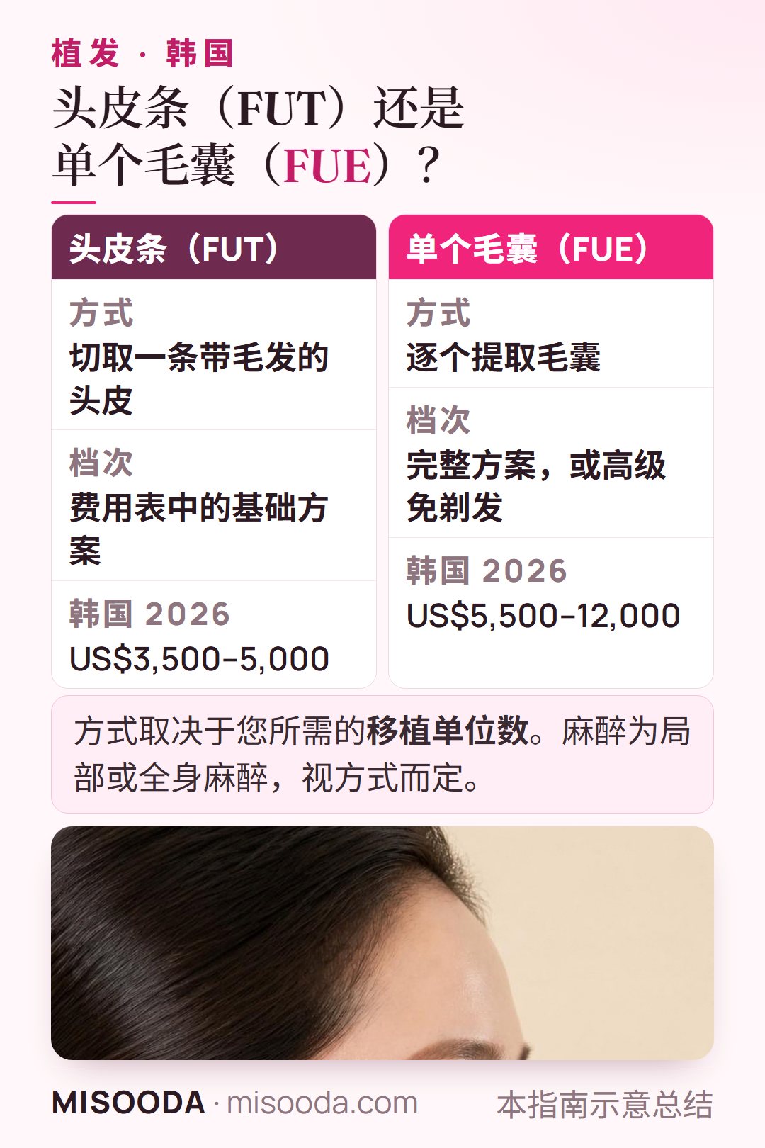 韩国 植发方式对比:FUT 切取一条头皮,US$3,500–5,000;FUE 逐个提取毛囊,US$5,500–12,000