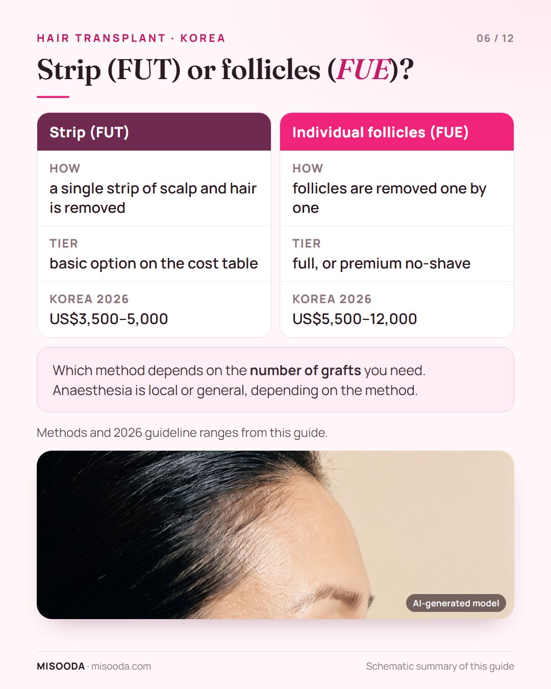 Hair transplant methods compared: FUT removes a single strip of scalp, US$3,500–5,000; FUE removes follicles individually, US$5,500–12,000 in Korea