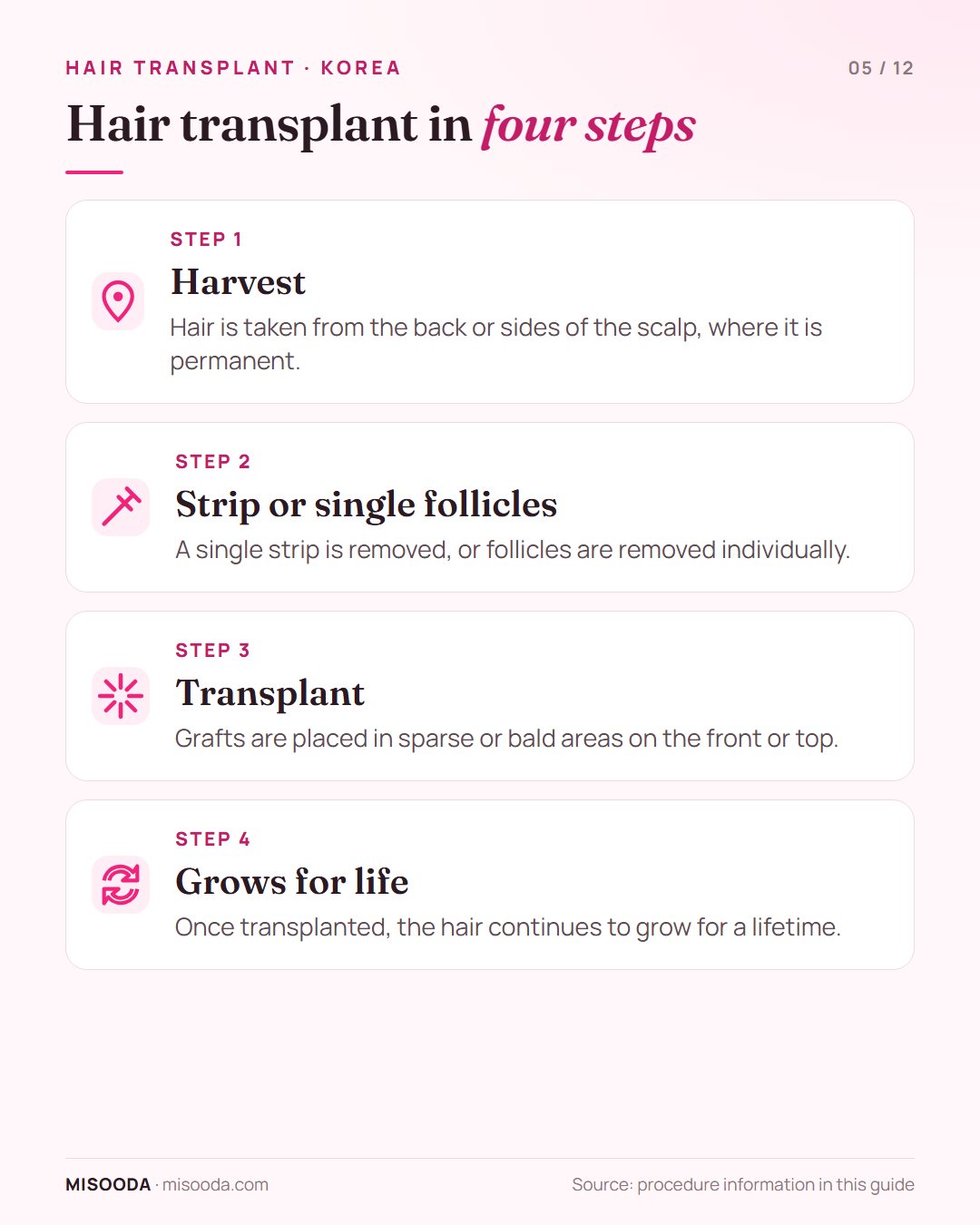 Hair transplant procedure in 4 steps: harvest permanent hair from the back or sides, remove a strip or single follicles, transplant to the front, grows for life