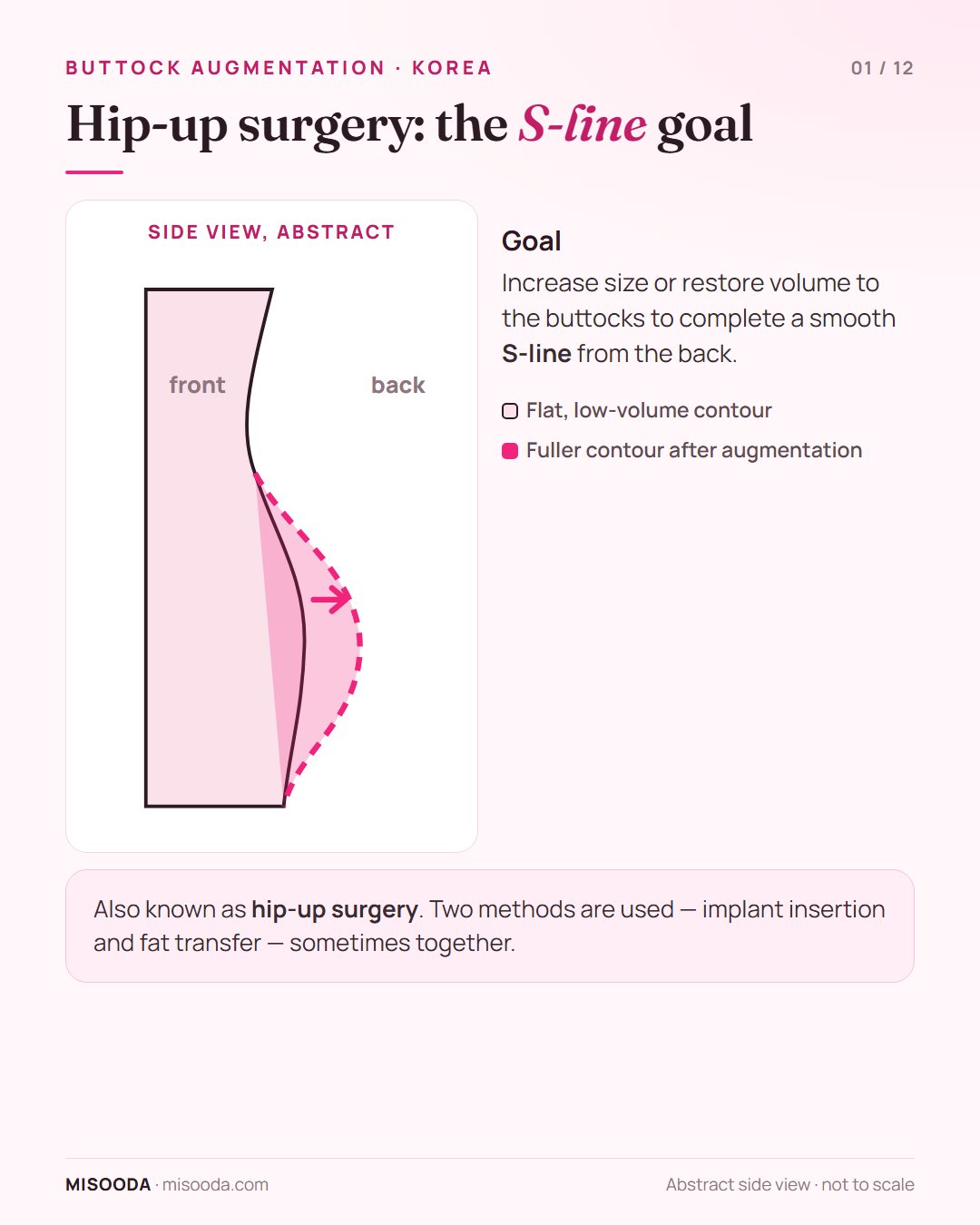 Buttock augmentation (hip-up surgery) goal shown as an abstract side view: a flat buttock contour made fuller to complete an S-line from the back
