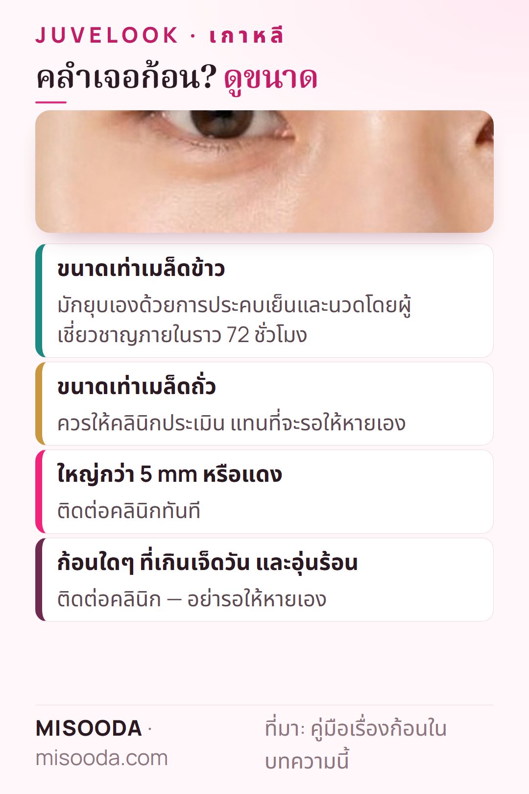 ทำอย่างไรเมื่อมีก้อนหลังทำ Juvelook: ขนาดเม็ดข้าวยุบด้วยประคบเย็นและนวดในราว 72 ชั่วโมง ขนาดเมล็ดถั่วให้คลินิกประเมิน ใหญ่กว่า 5 mm หรือแดงติดต่อคลินิก