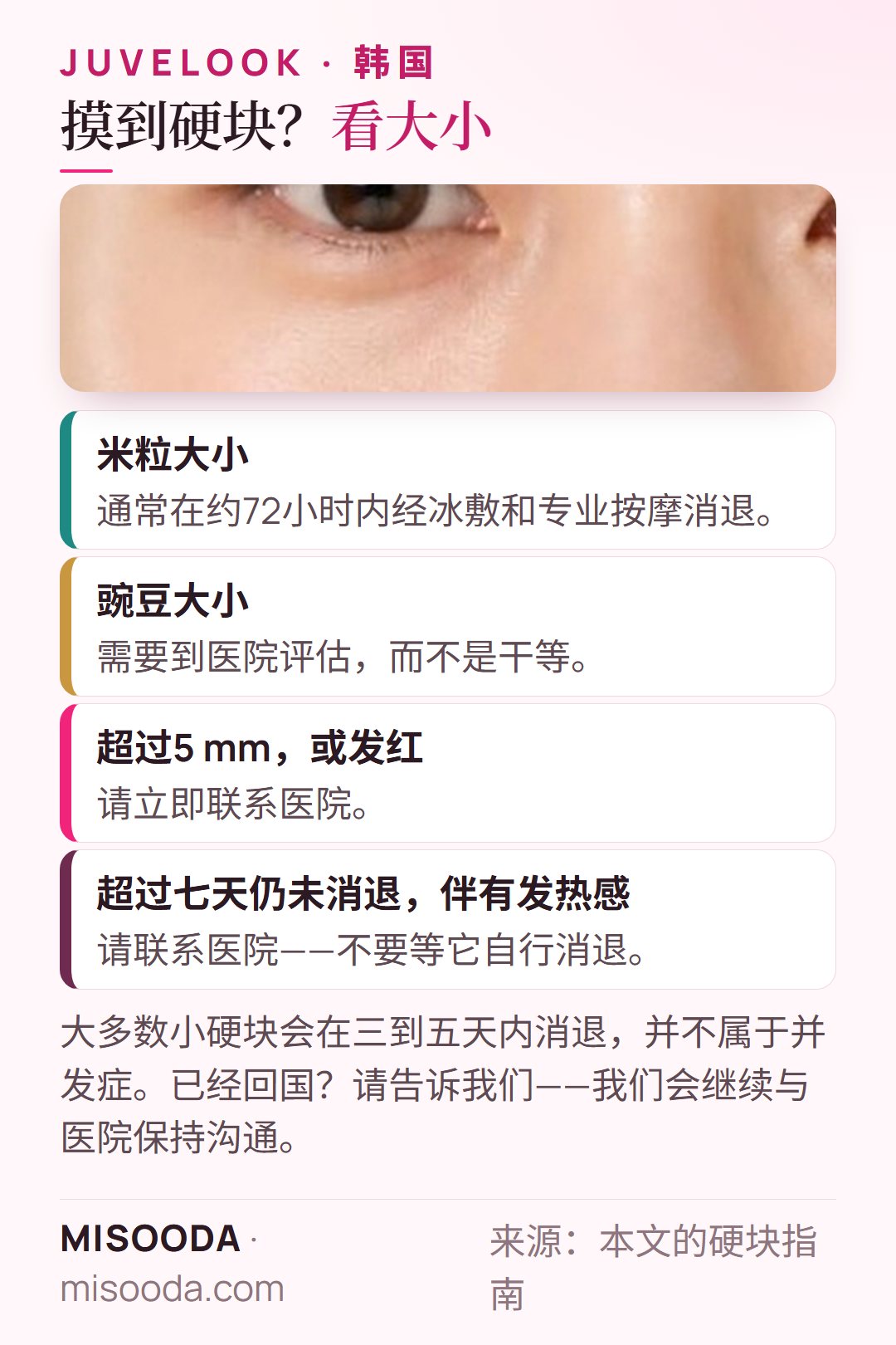 Juvelook 术后摸到硬块怎么办:米粒大小约72小时内经冰敷和按摩消退;豌豆大小需评估;超过5 mm或发红请联系医院