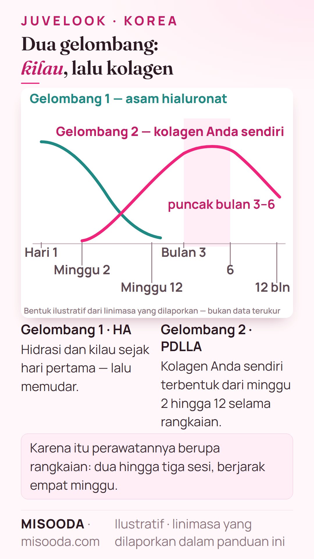 Linimasa dua gelombang Juvelook: hidrasi asam hialuronat sejak hari 1 yang memudar, lalu kolagen PDLLA terbentuk dari minggu 2 hingga 12 dan memuncak di bulan 3–6