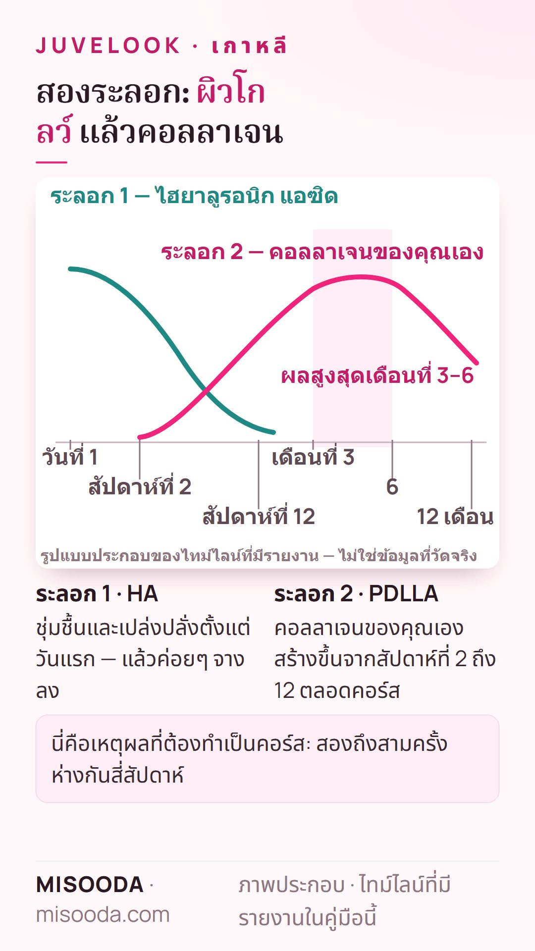 ไทม์ไลน์สองระลอกของ Juvelook เกาหลี: ไฮยาลูรอนิก แอซิดให้ความชุ่มชื้นตั้งแต่วันที่ 1 แล้วจางลง จากนั้น PDLLA สร้างคอลลาเจนสัปดาห์ที่ 2 ถึง 12 สูงสุดเดือนที่ 3–6