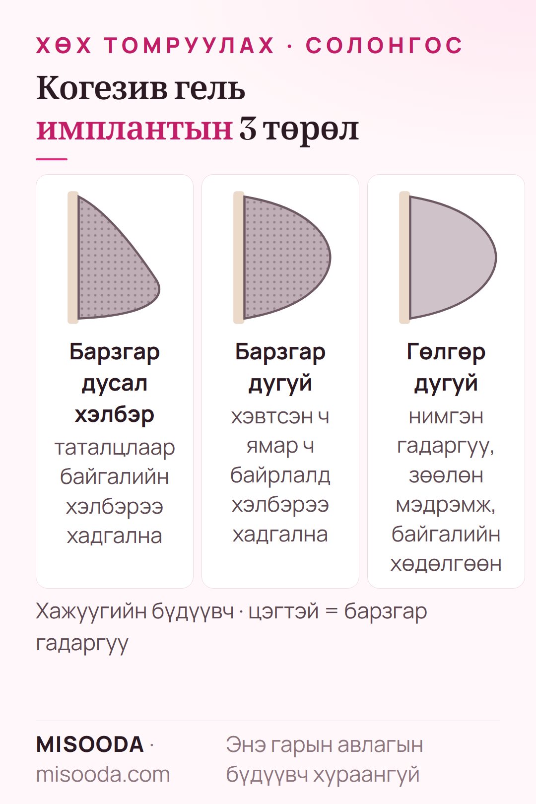 Солонгост хэрэглэдэг хөхний имплантын төрөл: барзгар дусал, барзгар дугуй, гөлгөр дугуй когезив гель имплантыг хэлбэр, мэдрэмжээр харьцуулав
