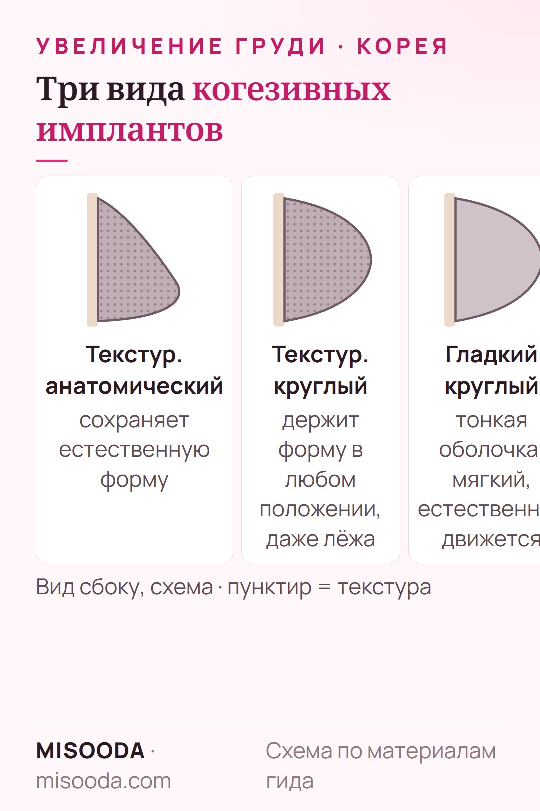 Типы имплантов груди в Корее: текстурированный анатомический, текстурированный круглый и гладкий круглый когезивные импланты — сравнение формы и ощущений