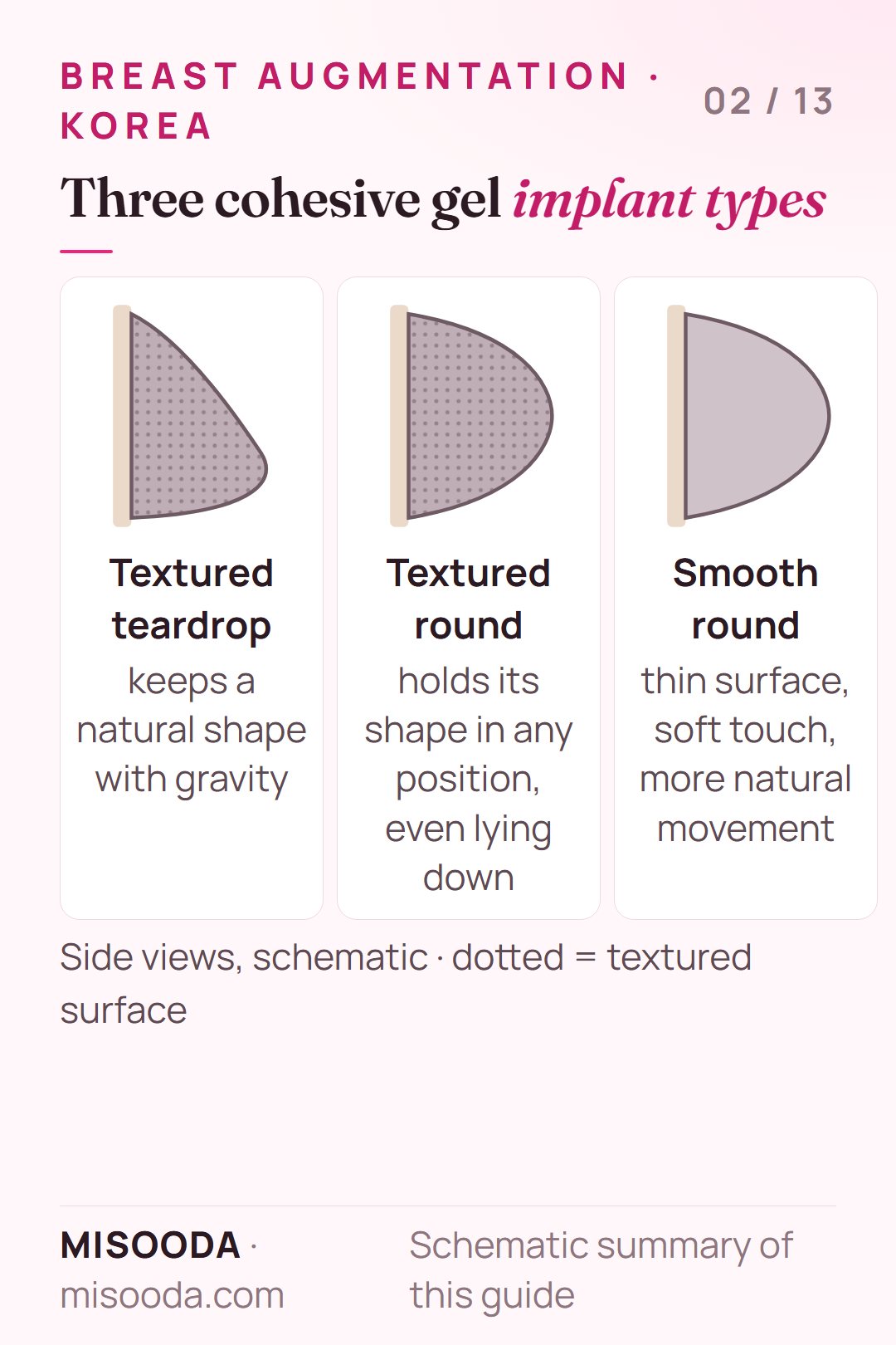 Breast implant types used in Korea: textured teardrop, textured round and smooth round cohesive gel implants compared by shape and feel