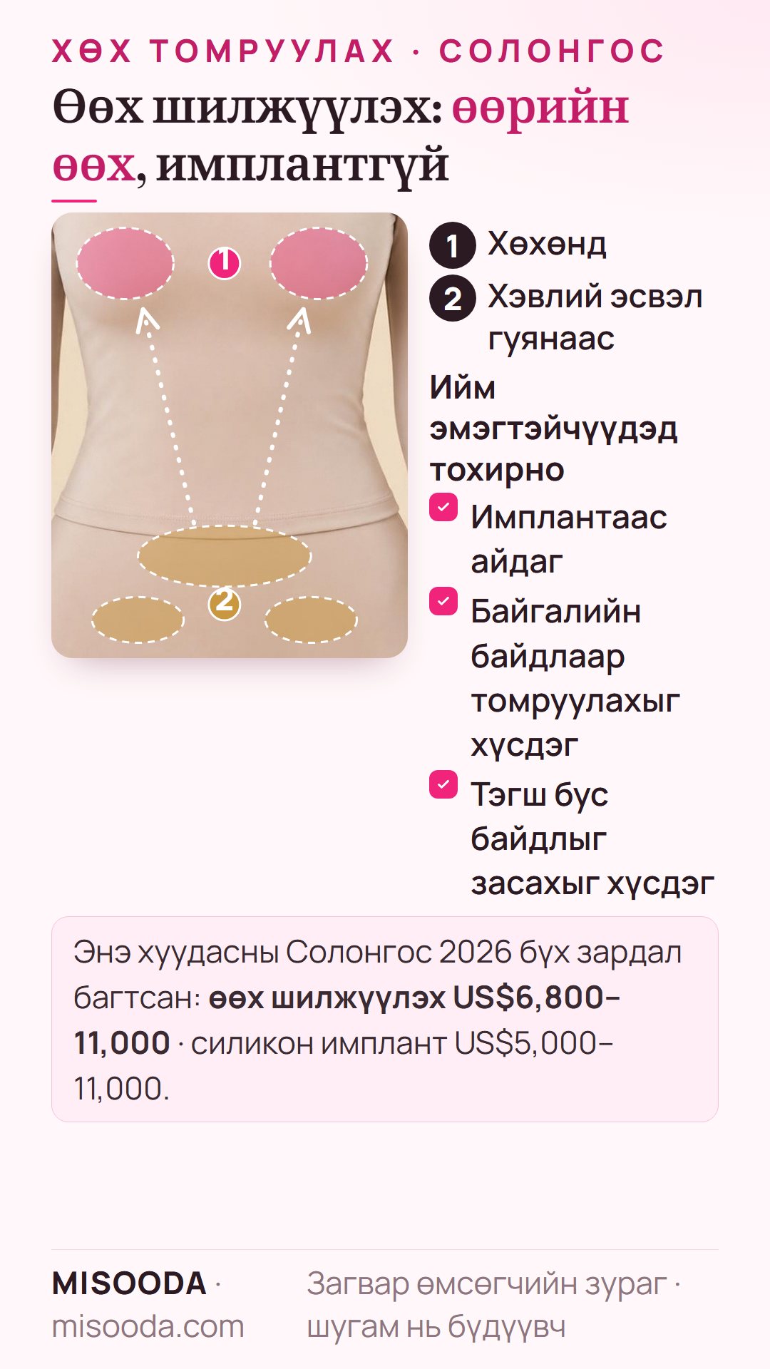 Өөх шилжүүлэн хөх томруулах: хэвлий эсвэл гуянаас өөх соруулалтаар авсан өөхийг хөхөнд тарина, Солонгост ~US$6,800–11,000