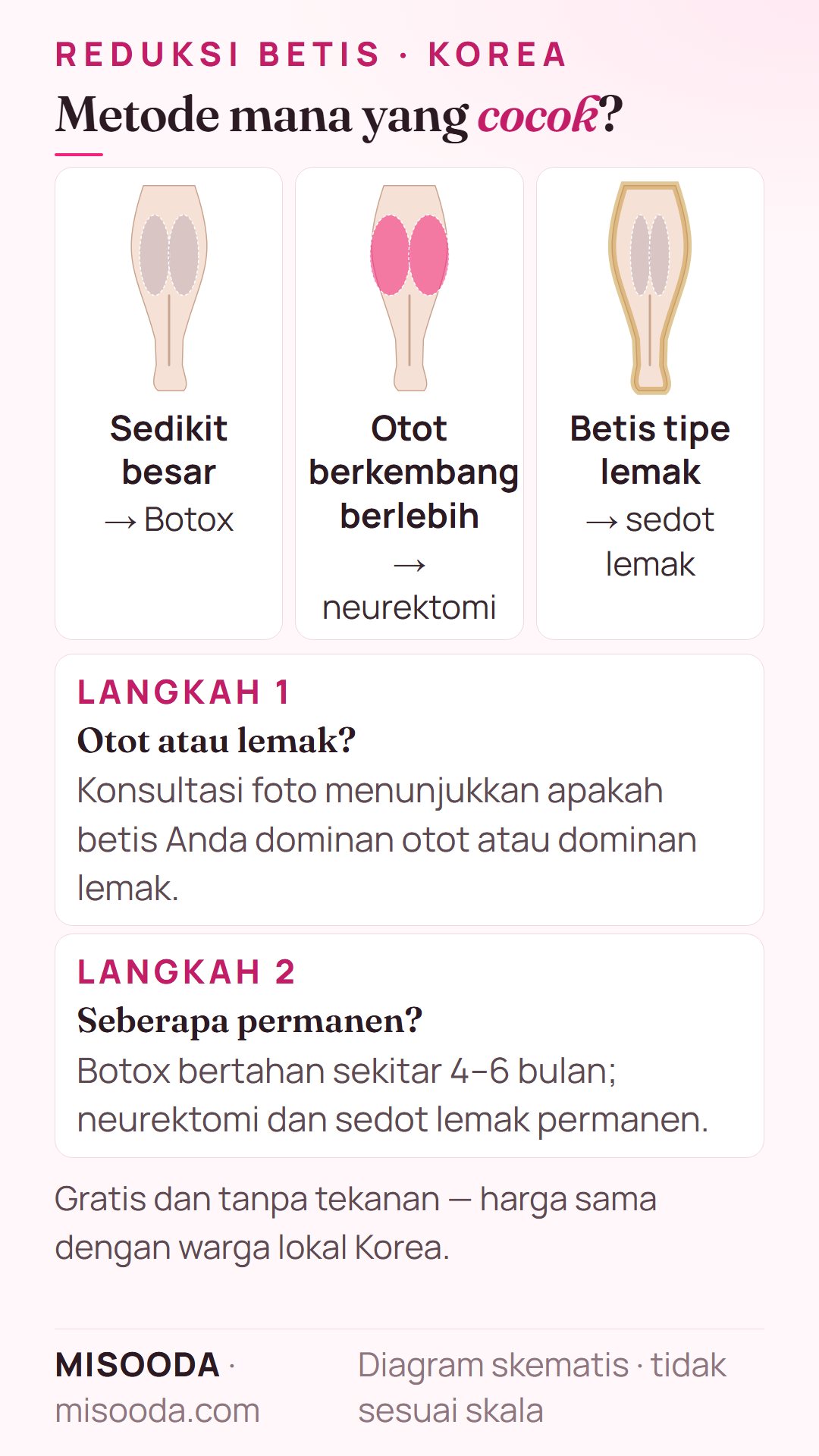 Cara memilih metode reduksi betis: betis dominan otot atau lemak, dan seberapa permanen hasil yang diinginkan — Botox, neurektomi atau sedot lemak