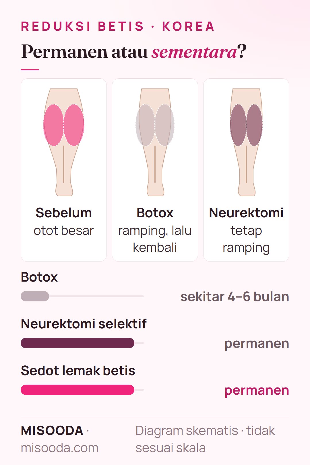 Hasil reduksi betis: Botox bertahan sekitar 4–6 bulan, sedangkan neurektomi selektif dan reduksi otot permanen dan otot tidak tumbuh kembali