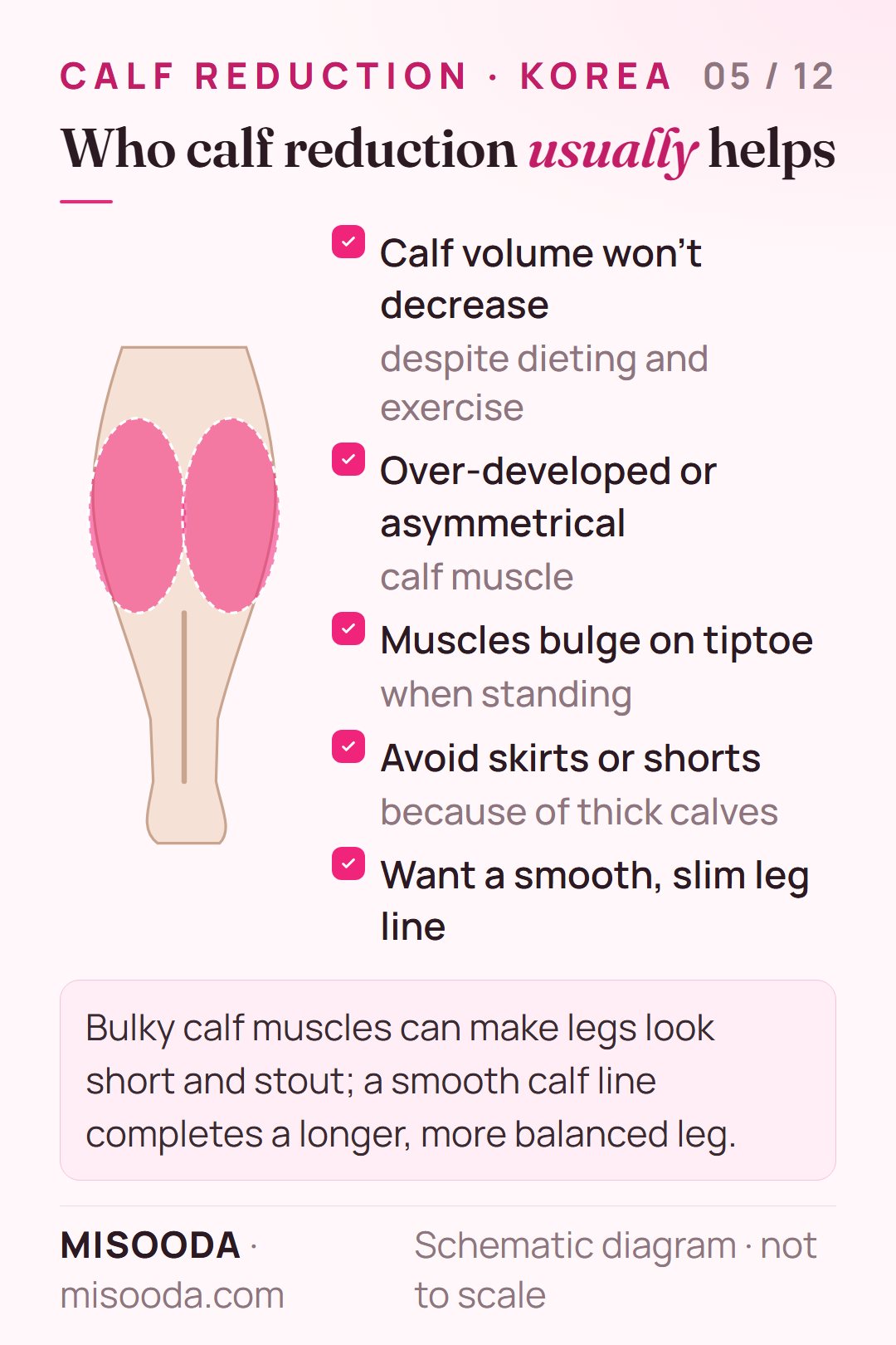 Calf reduction candidates: calves that won't slim with diet and exercise, over-developed or asymmetrical muscle, bulging on tiptoe, avoiding skirts