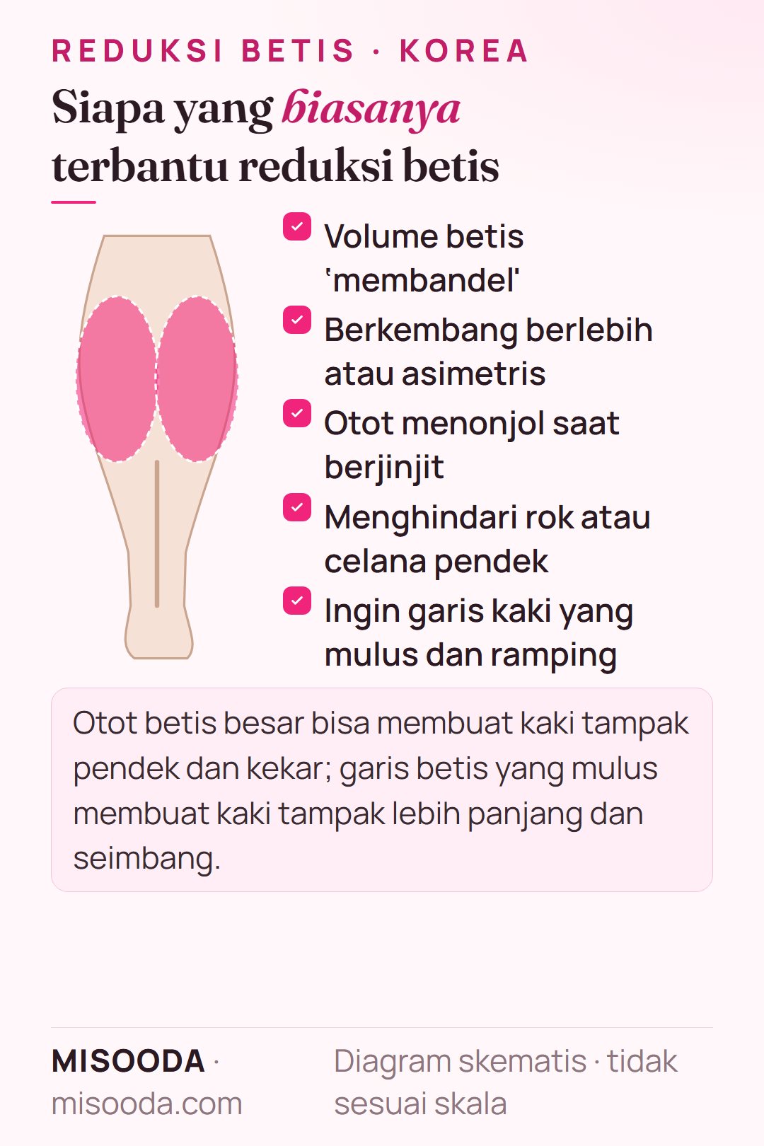 Kandidat reduksi betis: betis yang tak mengecil dengan diet dan olahraga, otot berkembang berlebih atau asimetris, menonjol saat berjinjit, menghindari rok