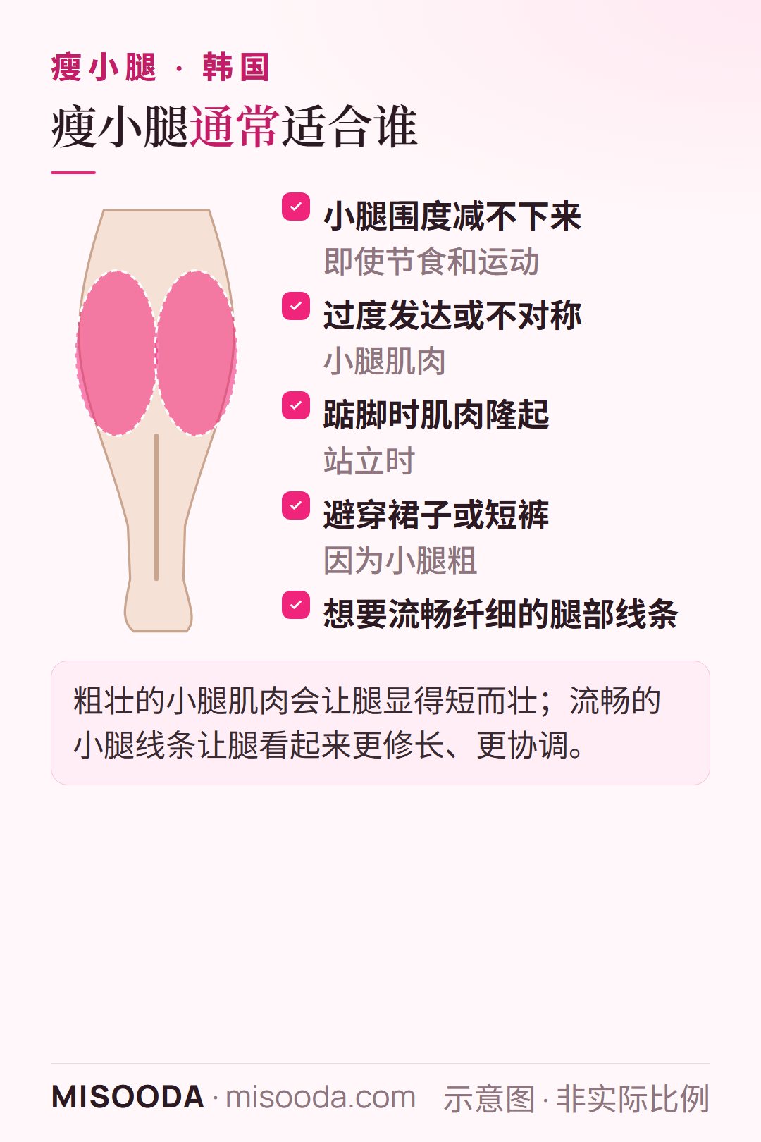 韩国 瘦小腿适合人群:节食和运动也瘦不下来的小腿、肌肉过度发达或不对称、踮脚时隆起、因此避穿裙子