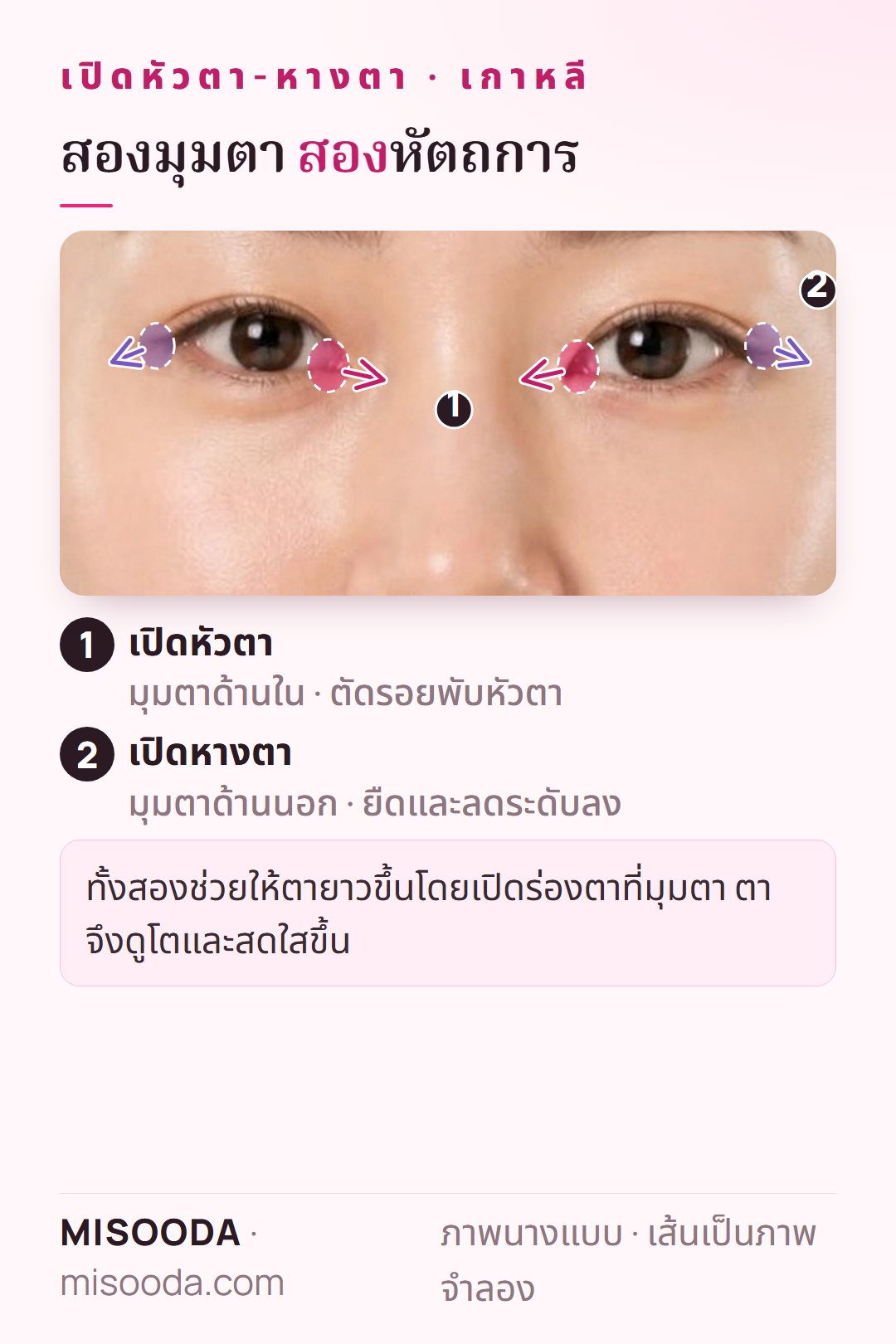 แผนที่เปิดหัวตา-หางตา เกาหลี บนดวงตาทั้งสองข้าง: เปิดหัวตาตัดรอยพับหัวตาที่มุมด้านใน เปิดหางตายืดและลดระดับมุมด้านนอก