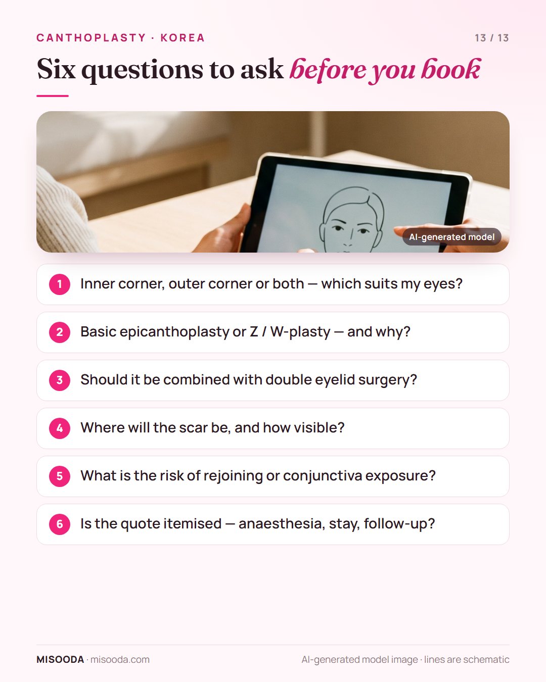 Six questions before booking epicanthoplasty or canthoplasty in Korea: which corner, basic or Z/W-plasty, combining with double eyelid, scars, rejoining, quote