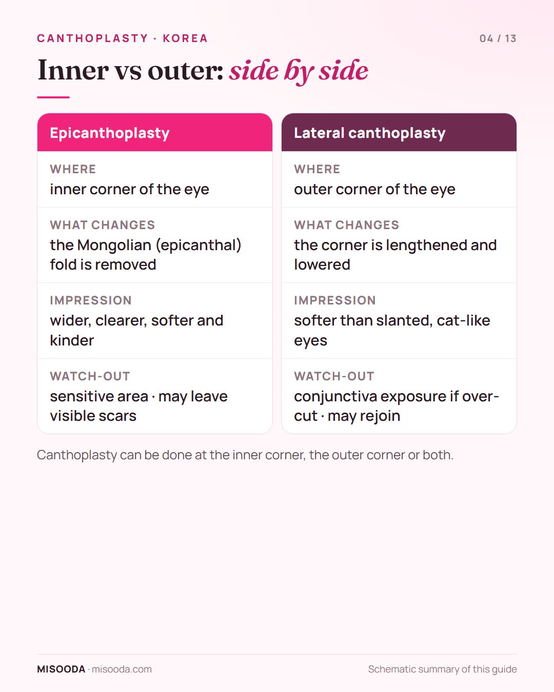 Epicanthoplasty vs lateral canthoplasty compared: inner corner fold removal vs outer corner lengthening, the impression each gives and each watch-out