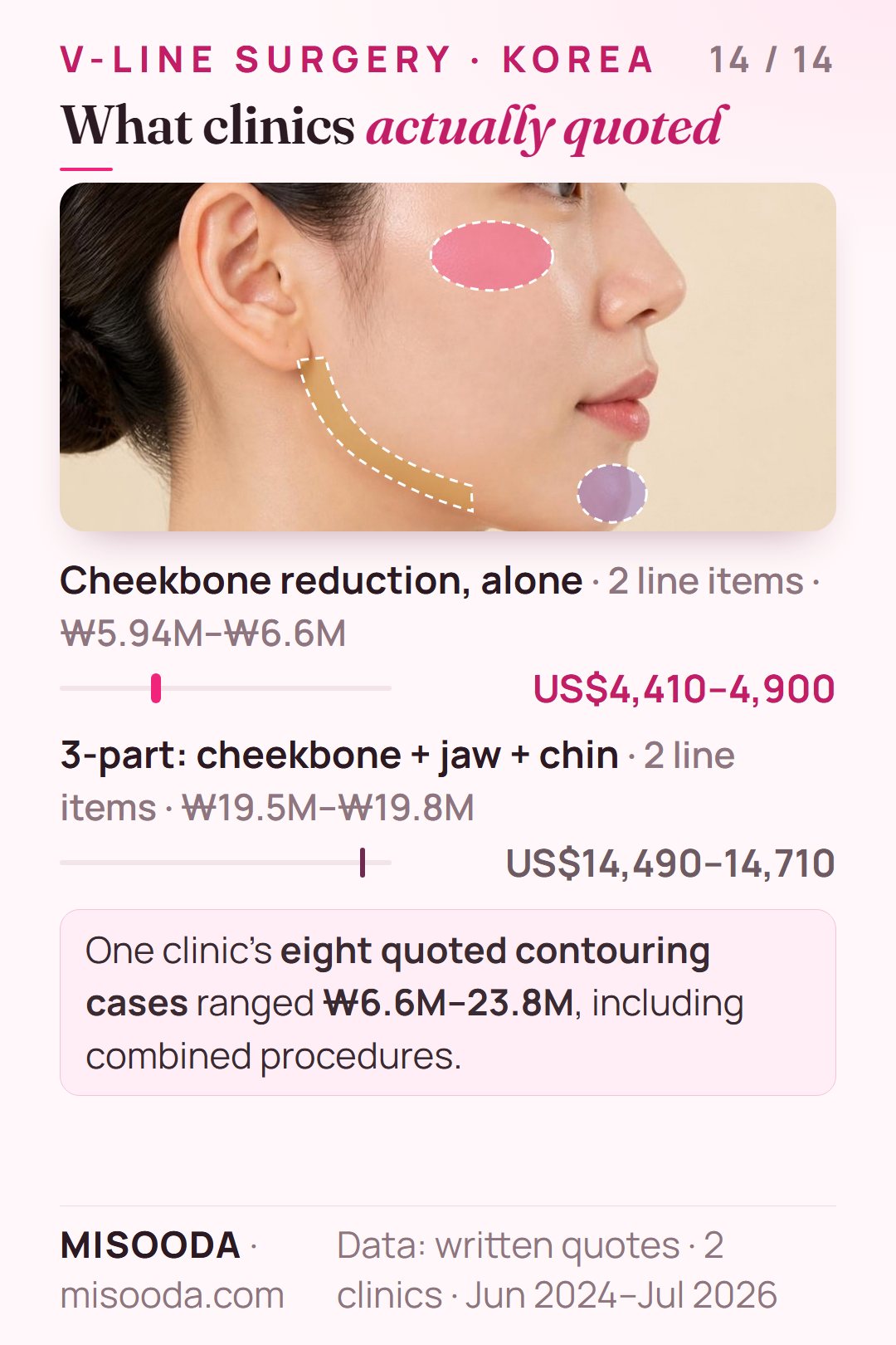 Real Korean V-line and facial contouring quotes 2024–2026: cheekbone reduction alone US$4,410–4,900, 3-part cheekbone, square jaw and chin US$14,490–14,710