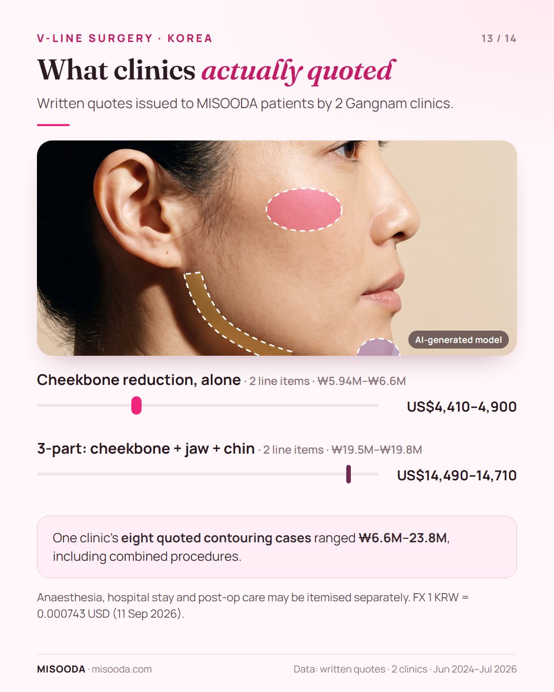 Real Korean V-line and facial contouring quotes 2024–2026: cheekbone reduction alone US$4,410–4,900, 3-part cheekbone, square jaw and chin US$14,490–14,710