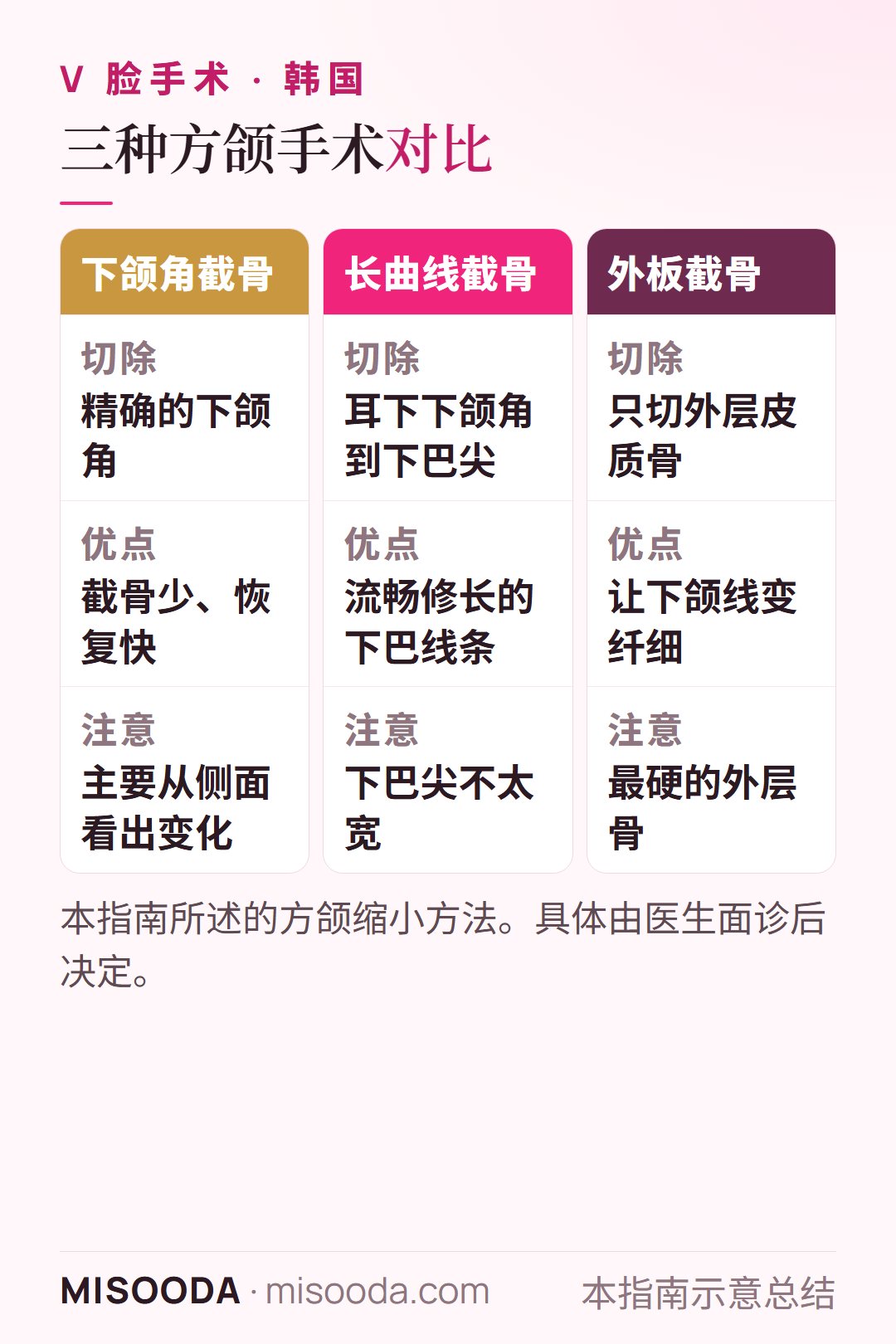 韩国 方颌缩小方法对比:下颌角截骨、从下颌角到下巴尖的长曲线截骨,以及只修薄外层的外板截骨