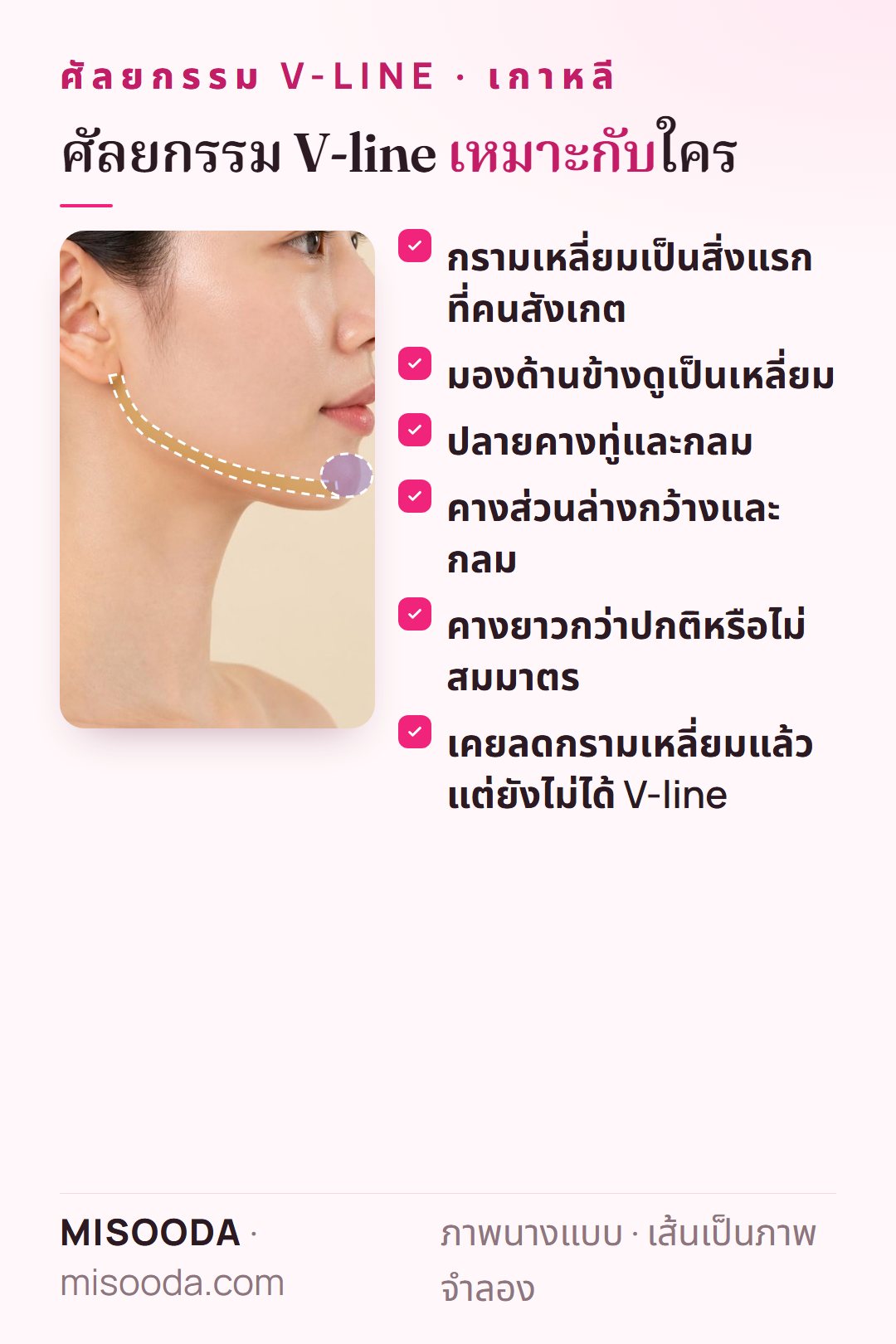 ผู้ที่เหมาะกับศัลยกรรม V-line: กรามเหลี่ยมเป็นสิ่งแรกที่สังเกต ด้านข้างดูเหลี่ยม คางทู่ กว้าง ยาว หรือไม่สมมาตร หรือยังไม่ได้ V-line หลังลดกราม