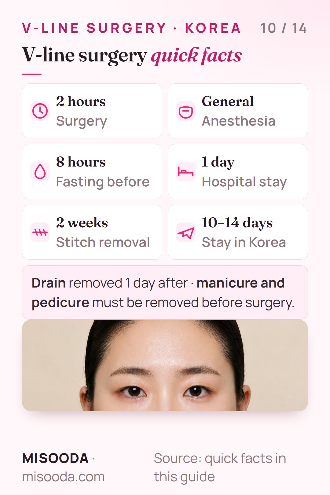V-line surgery quick facts: 2 hours under general anesthesia, fasting from 8 hours before, 1 day in hospital, stitches out after 2 weeks, 10–14 days in Korea