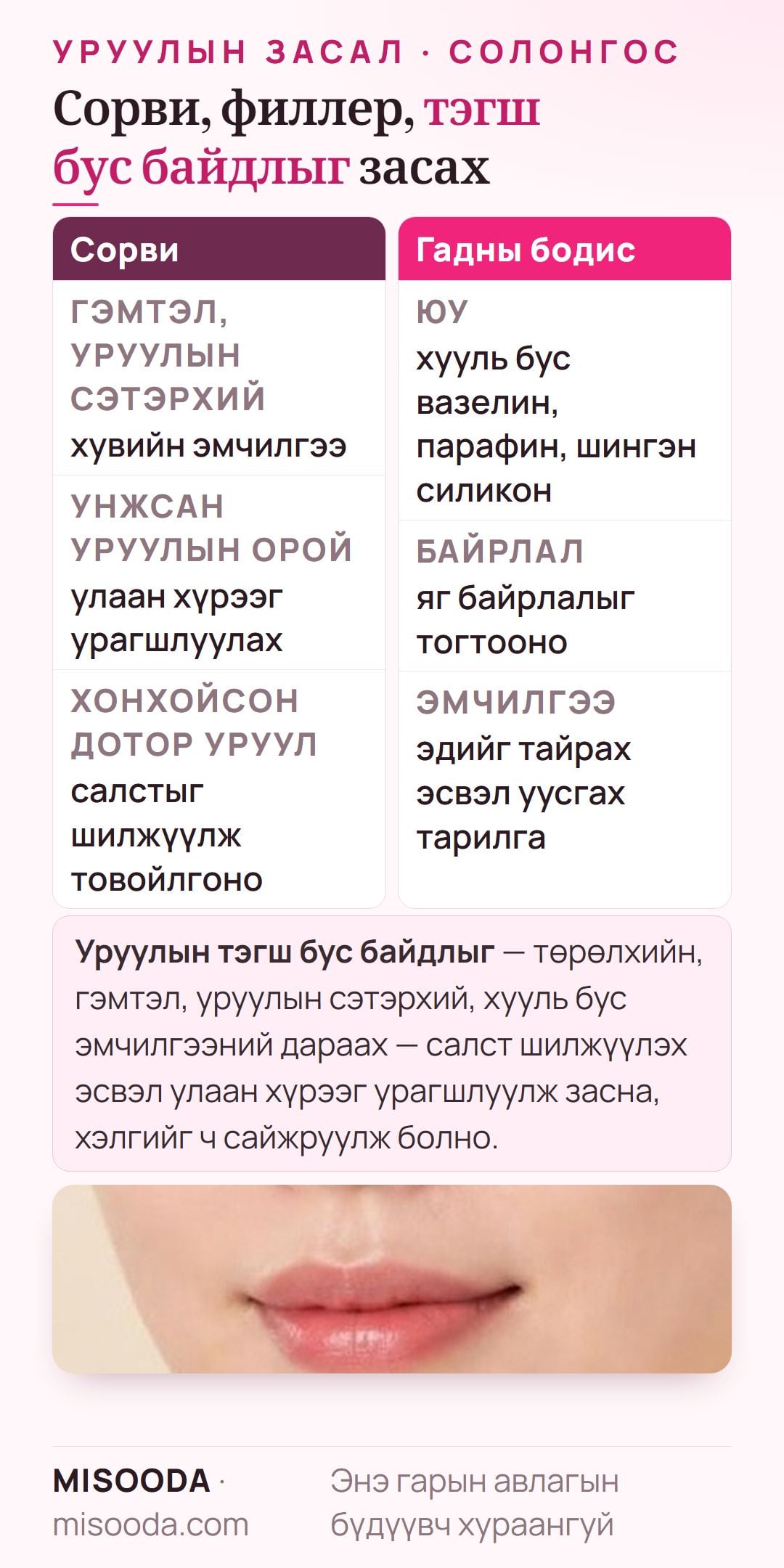 Уруул засах мэс засал: гэмтэл, уруулын сэтэрхийн сорви, хууль бус вазелин, парафин, шингэн силикон авах, уруулын тэгш бус байдал, хэлгийг засах