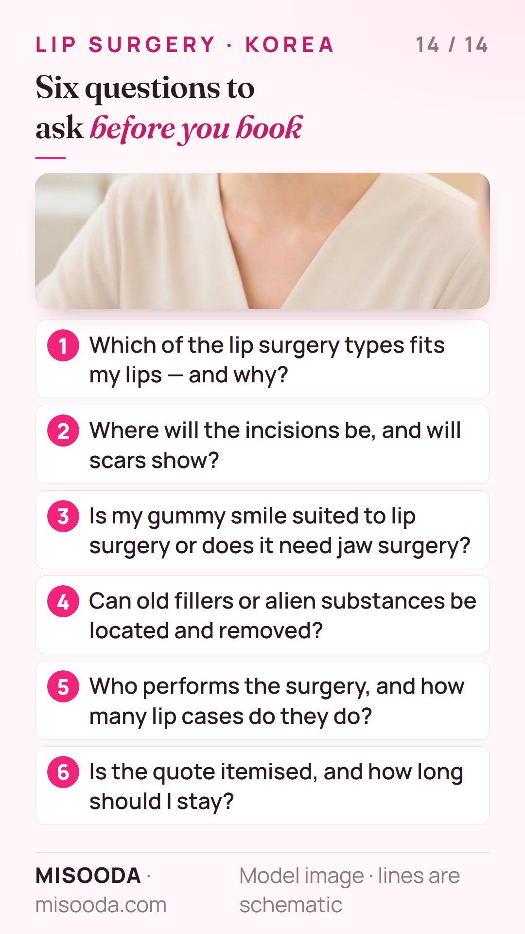 Six questions before booking lip surgery in Korea: which type fits, incision and scars, gummy smile options, old filler removal, surgeon, itemised quote