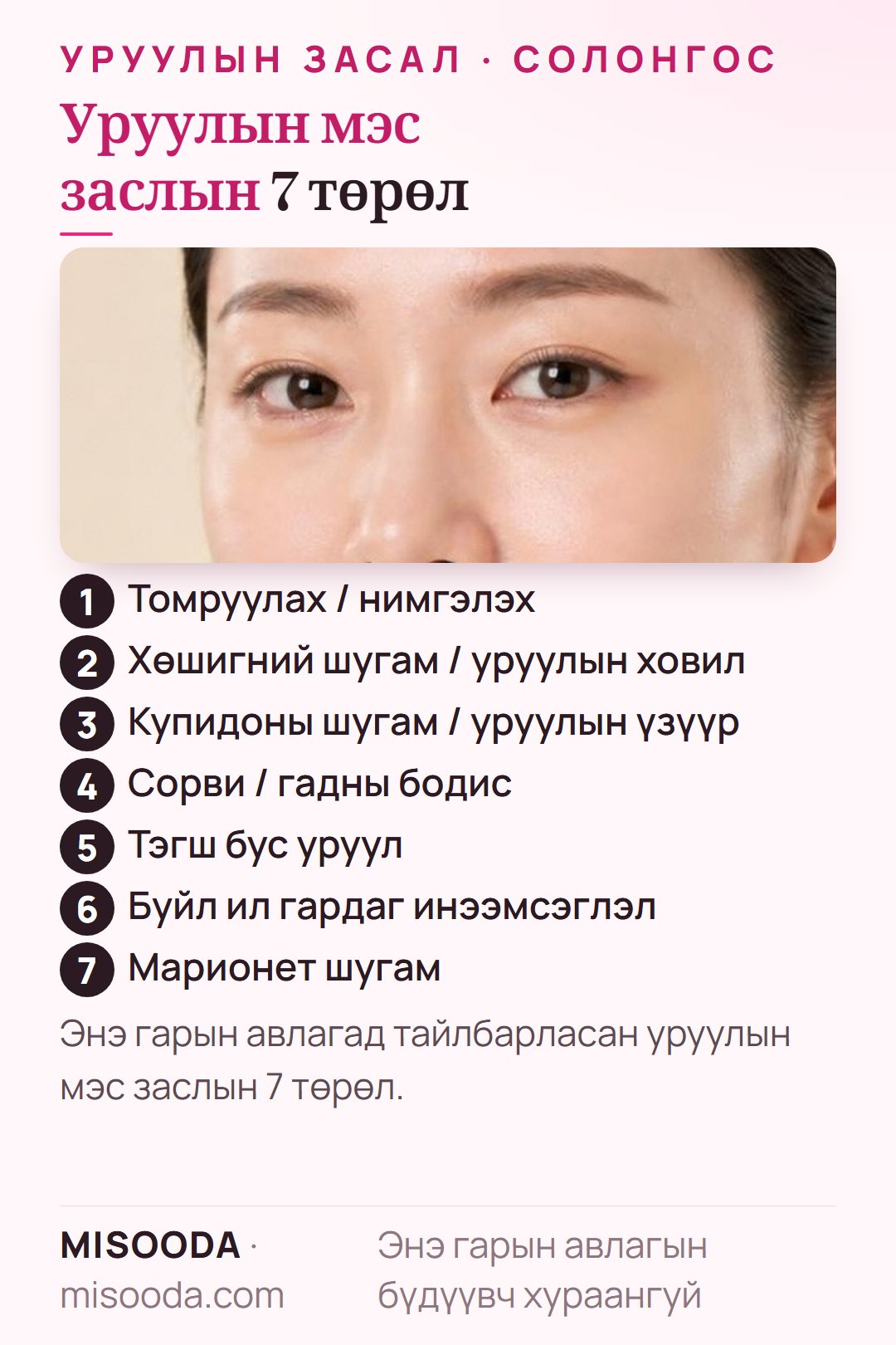 Солонгост уруулын гоо сайхны мэс заслын 7 төрөл: томруулах, нимгэлэх, хөшигний шугам ба ховил, купидоны шугам ба үзүүр, сорви, тэгш бус байдал, буйл ил гардаг инээмсэглэл, марионет