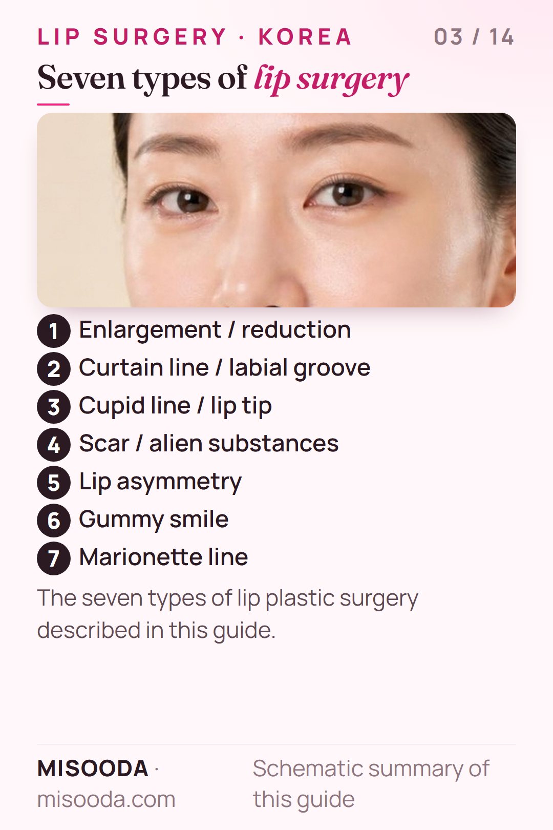 Seven types of lip plastic surgery in Korea: enlargement or reduction, curtain line and labial groove, cupid line and lip tip, scars, asymmetry, gummy smile, marionette