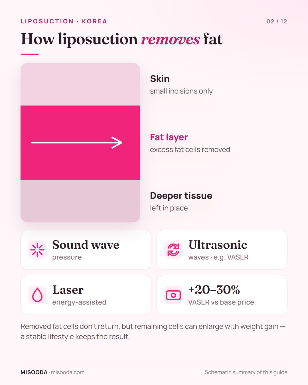 How liposuction works: excess fat cells removed from the fat layer using sound-wave pressure, ultrasonic waves or laser; VASER adds about 20–30% to the price