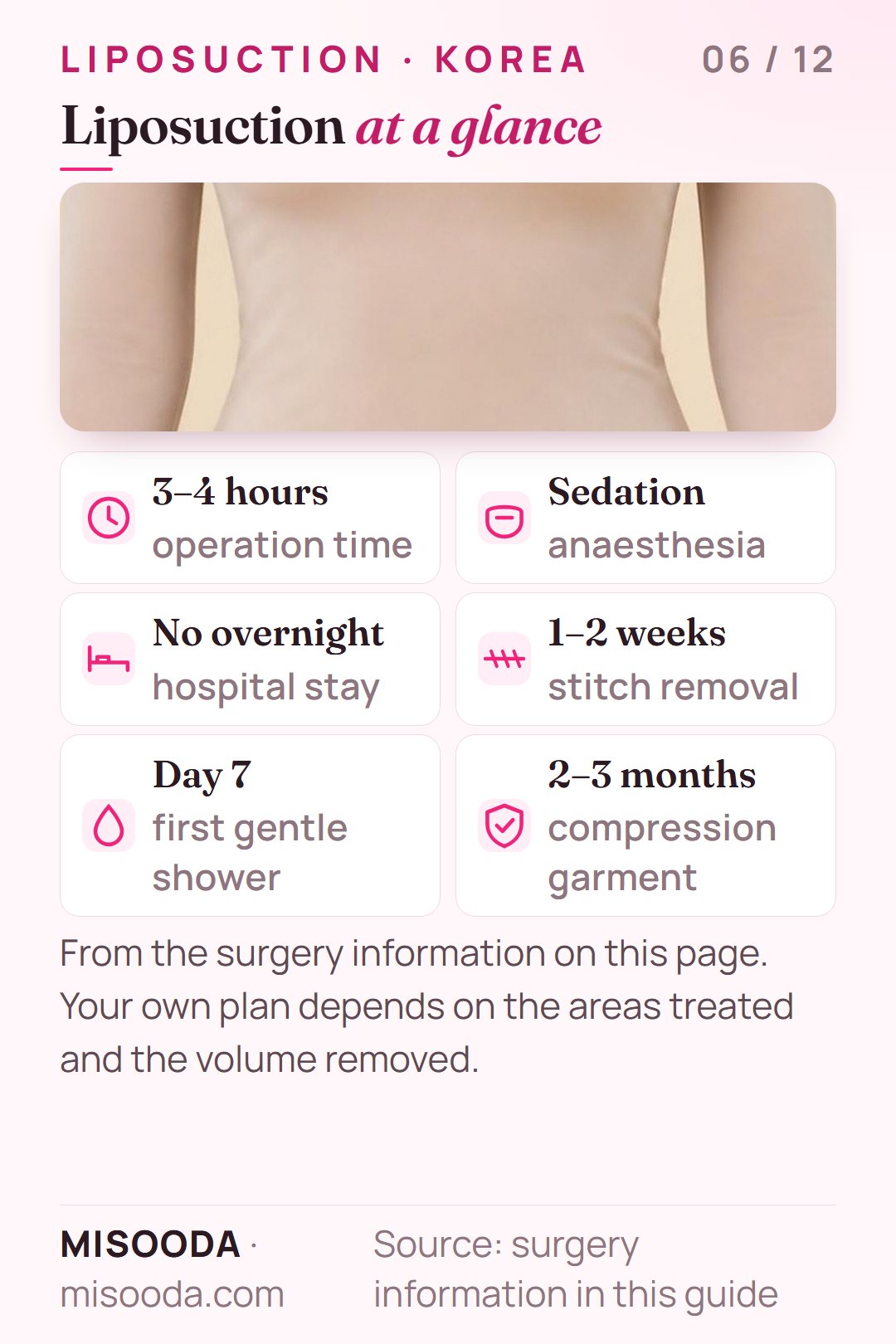 Liposuction quick facts: 3–4 hours under sedation anaesthesia, no overnight stay, stitches removed after 1–2 weeks, compression garment 2–3 months