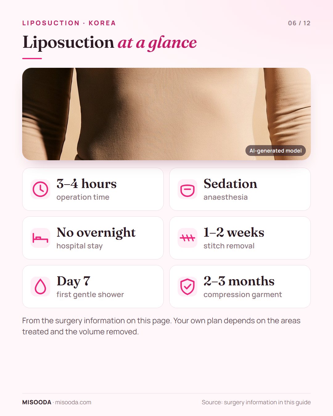 Liposuction quick facts: 3–4 hours under sedation anaesthesia, no overnight stay, stitches removed after 1–2 weeks, compression garment 2–3 months