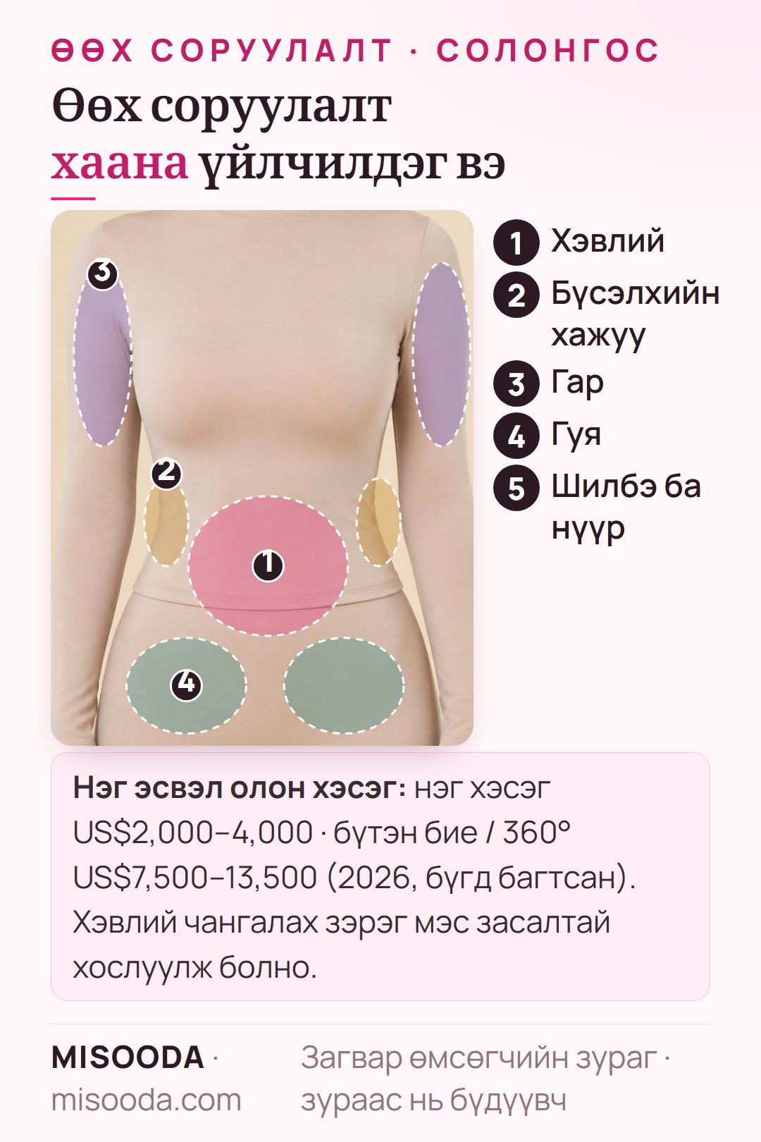 Солонгост өөх соруулах хэсгүүд бие дээр: хэвлий, бүсэлхийн хажуу, бугалга, гуя, мөн шилбэ ба нүүр