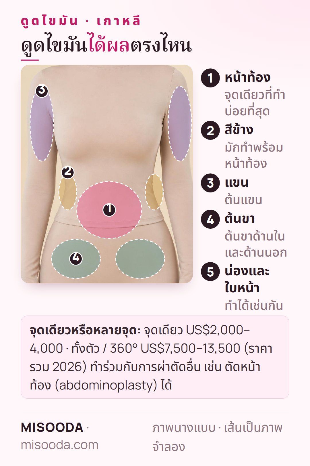 จุดที่ทำดูดไขมัน เกาหลี บนร่างกาย: หน้าท้อง สีข้าง (love handles) ต้นแขนและต้นขา รวมถึงน่องและใบหน้า