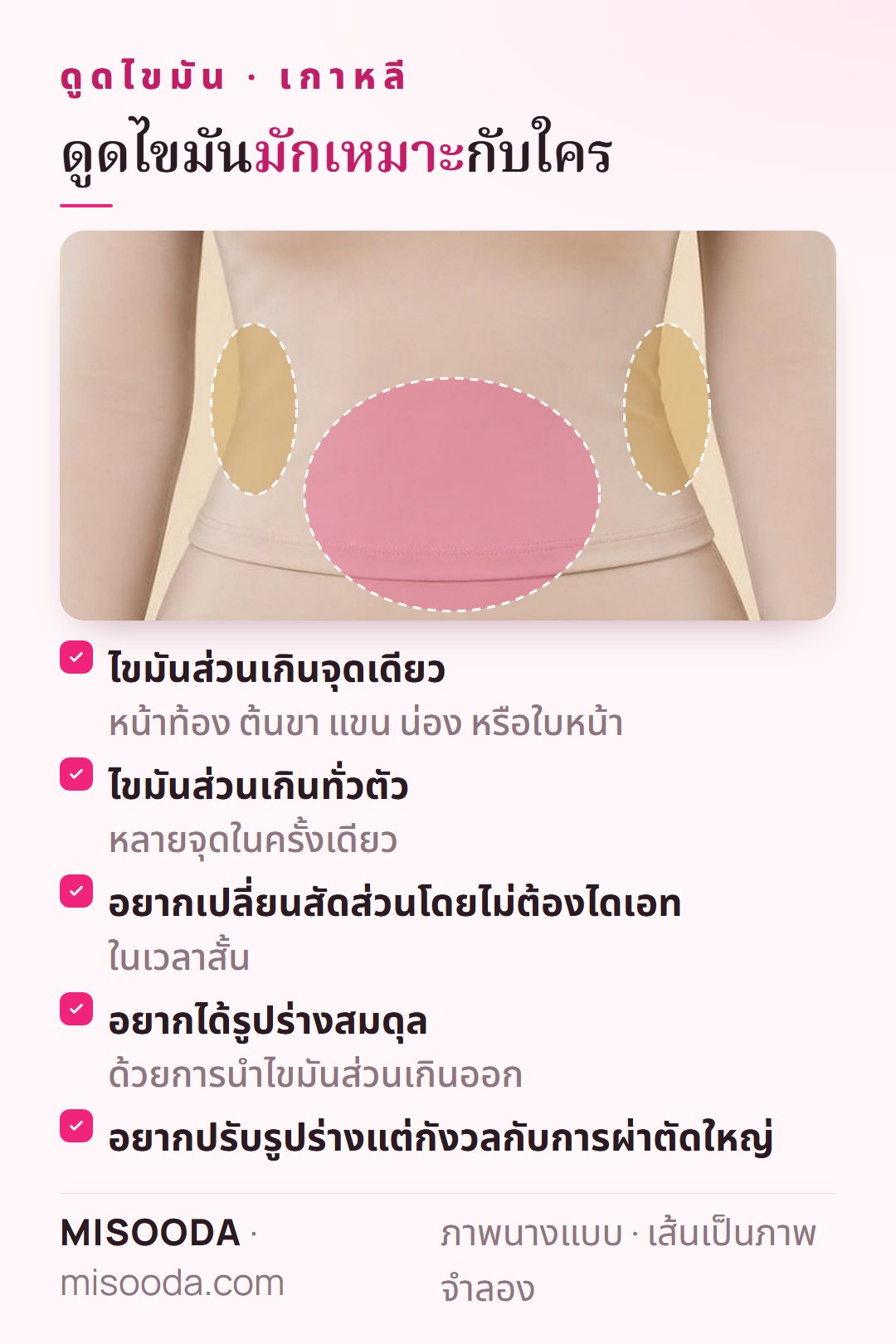 ผู้ที่เหมาะกับดูดไขมัน เกาหลี: ไขมันส่วนเกินจุดเดียว เช่น หน้าท้อง ต้นขา หรือแขน ไขมันทั่วตัว หรืออยากเปลี่ยนสัดส่วนโดยไม่ต้องไดเอท