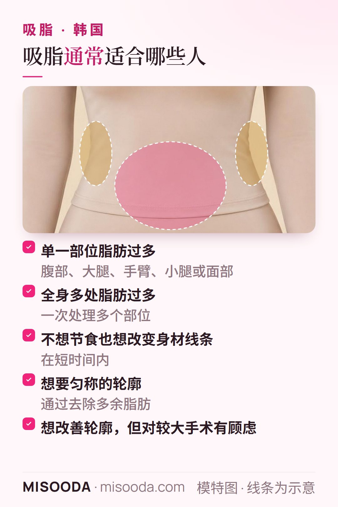 韩国 吸脂适合人群:腹部、大腿或手臂等单一部位脂肪过多、全身多处脂肪,或不想节食也想改变身材线条